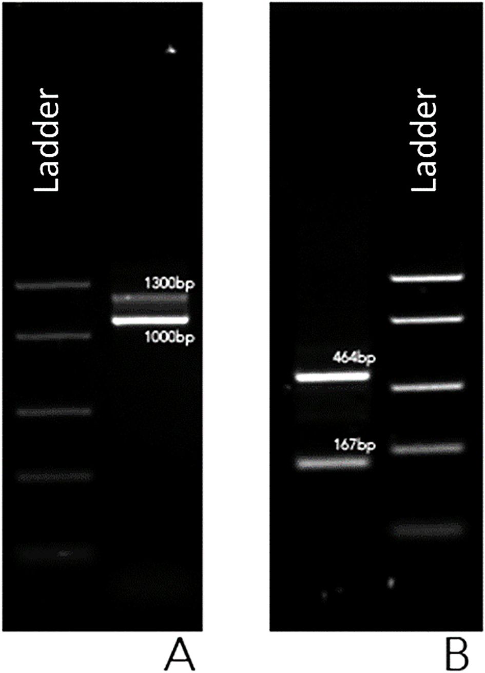 Gel electrophoresis image with two panels labeled A and B, both featuring a DNA ladder. Panel A shows bands at 1300 base pairs and 1000 base pairs. Panel B shows bands at 464 base pairs and 167 base pairs.