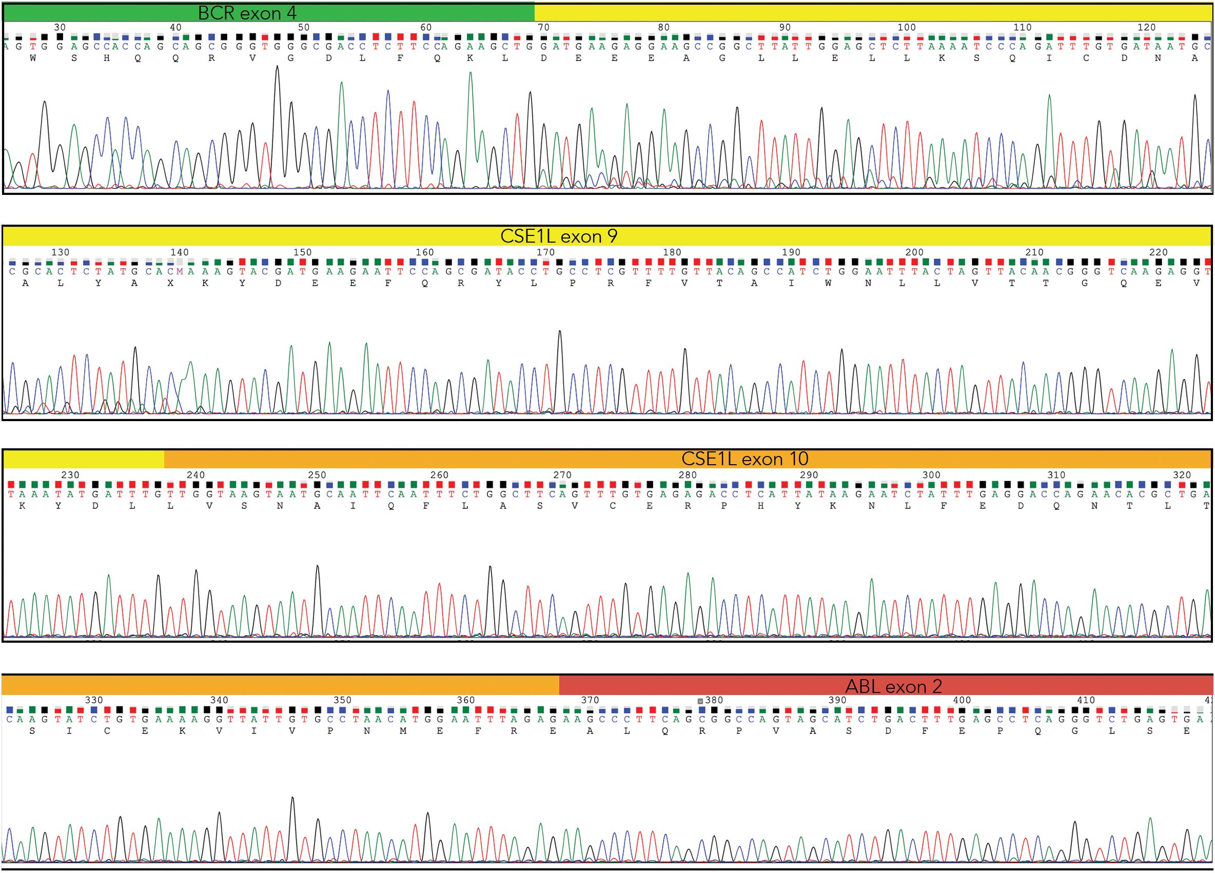 DNA sequencing chromatograms of four different exons: BCR exon 4, CSE1L exon 9, CSE1L exon 10, and ABL exon 2. Each chromatogram displays peaks in various colors representing nucleotide bases, with corresponding sequence alignments labeled above.