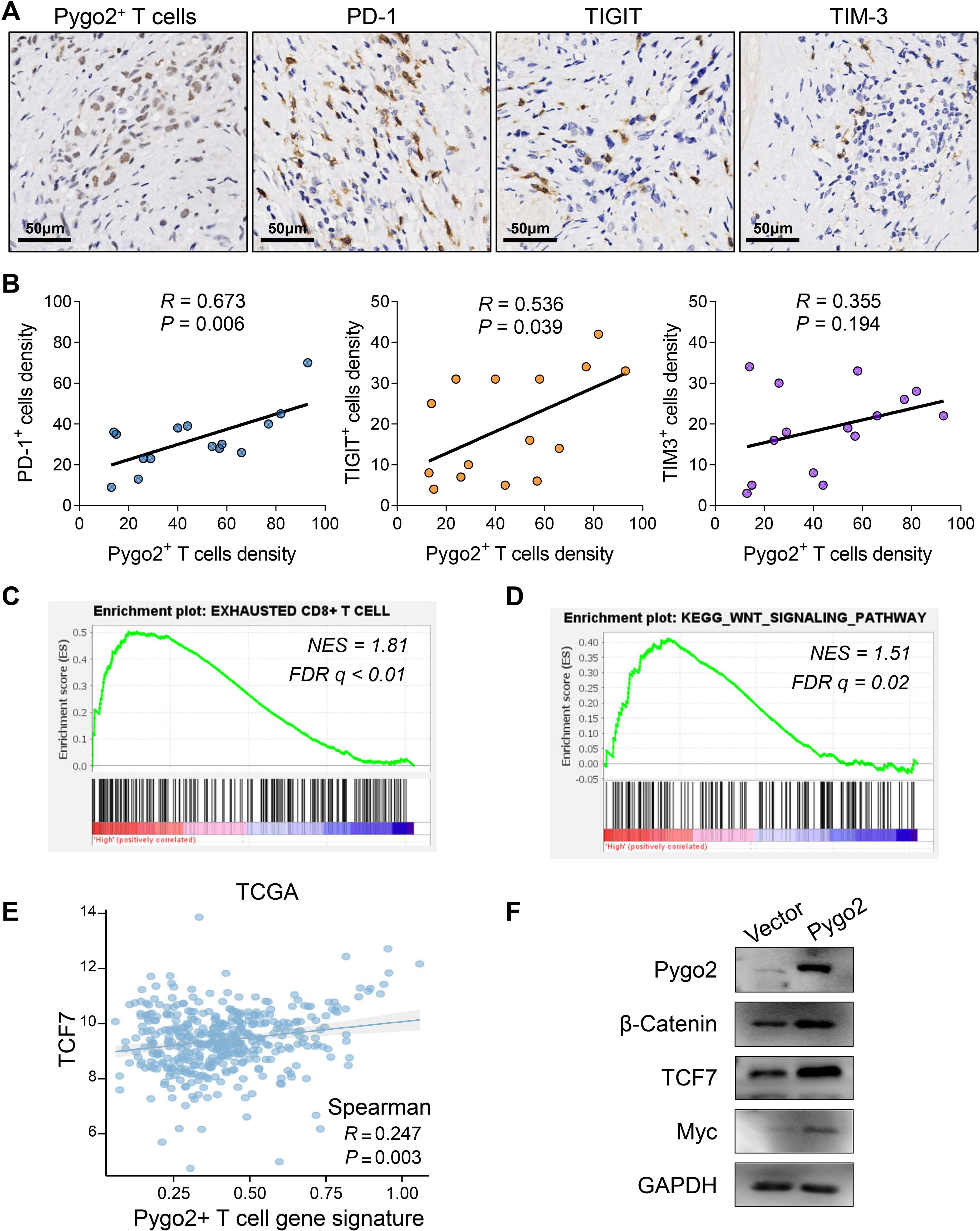 Panel A shows immunohistochemical staining of Pygo2, PD-1, TIGIT, and TIM-3 T cells with varying densities. Panel B presents scatter plots correlating Pygo2\(^+\) T cell density with PD-1, TIGIT, and TIM-3 expression, showing correlation coefficients and p-values. Panel C and D feature enrichment plots for exhausted CD8\(^+\) T cells and KEGG WNT signaling pathway, with NES and FDR values. Panel E displays a scatter plot correlating TCF7 expression with Pygo2\(^+\) T cell gene signature, including Spearman correlation data. Panel F contains Western blot images of proteins: Pygo2, β-Catenin, TCF7, Myc, and GAPDH, comparing vector and Pygo2.