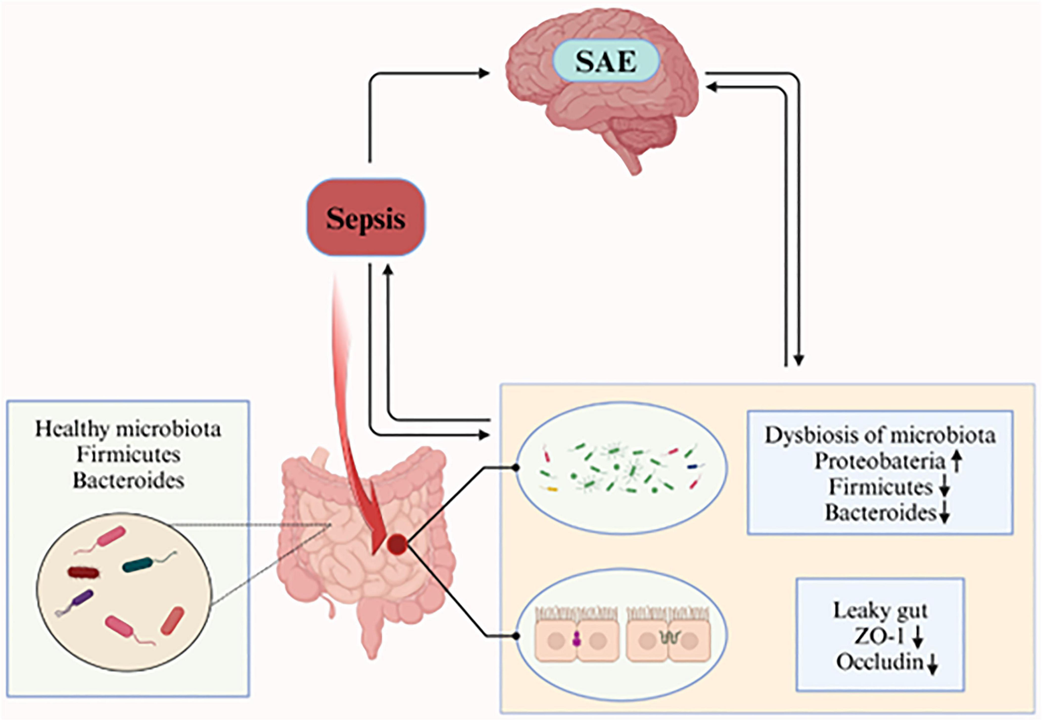 Diagram illustrating the relationship between gut health and sepsis. The gut with healthy microbiota, including Firmicutes and Bacteroides, disrupts due to dysbiosis involving increased Proteobacteria and changes in Firmicutes and Bacteroides levels. This condition leads to a leaky gut, indicated by decreased ZO-1 and Occludin, contributing to sepsis and SAE (Sepsis-Associated Encephalopathy). Arrows depict progression and interaction pathways.