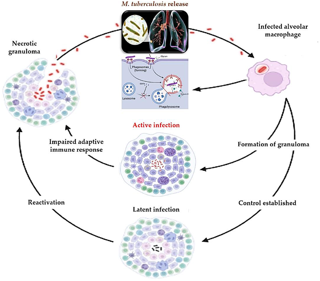 Diagram illustrating the tuberculosis infection cycle: inhaled bacteria infect alveolar macrophages, leading to granuloma formation. Active infection occurs, which can become latent or reactivate. Necrotic granulomas can release bacteria, impairing immune response.