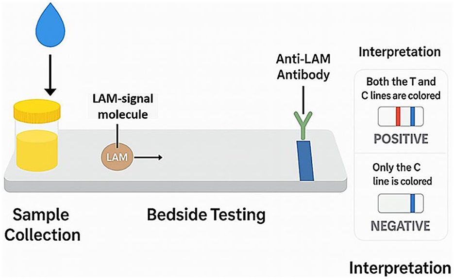 Diagram illustrating a bedside testing process for LAM detection. A sample is collected, releasing the LAM-signal molecule. During testing, the molecule interacts with an anti-LAM antibody. Results interpretation: both T and C lines colored indicate a positive result; only the C line colored indicates a negative result.