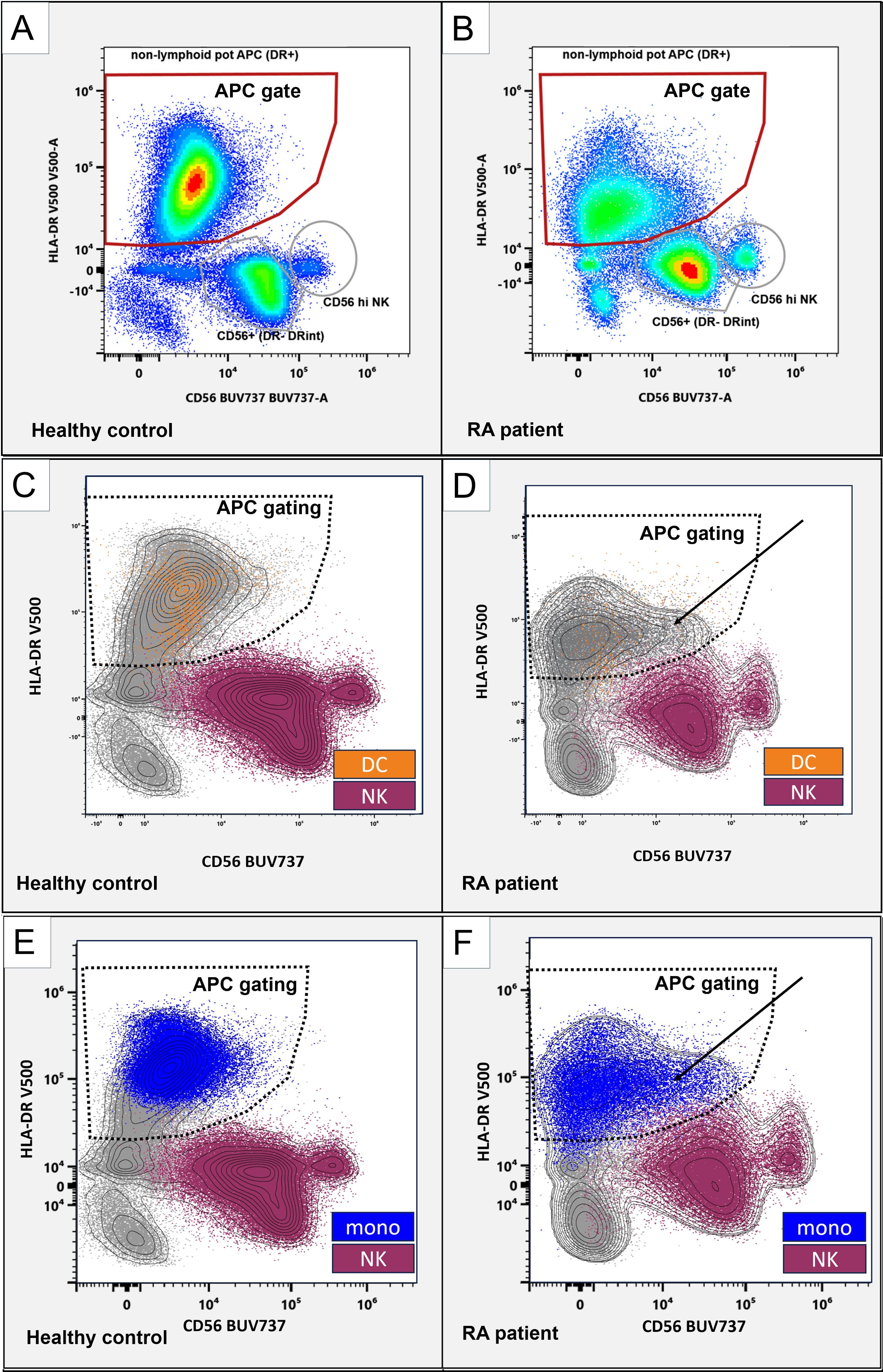 Flow cytometry dot plots comparing healthy controls and rheumatoid arthritis (RA) patients. Panels A and B depict non-lymphoid APC gating, showing differences in HLA-DR and CD56 expression. Panels C and D illustrate differences in dendritic cells (DC) and natural killer (NK) cells, with distinct gating regions. Panels E and F focus on monocytes (mono) and NK cells, highlighting altered distributions in RA patients compared to healthy controls. Each plot uses a combination of contour and color density to represent cell populations.