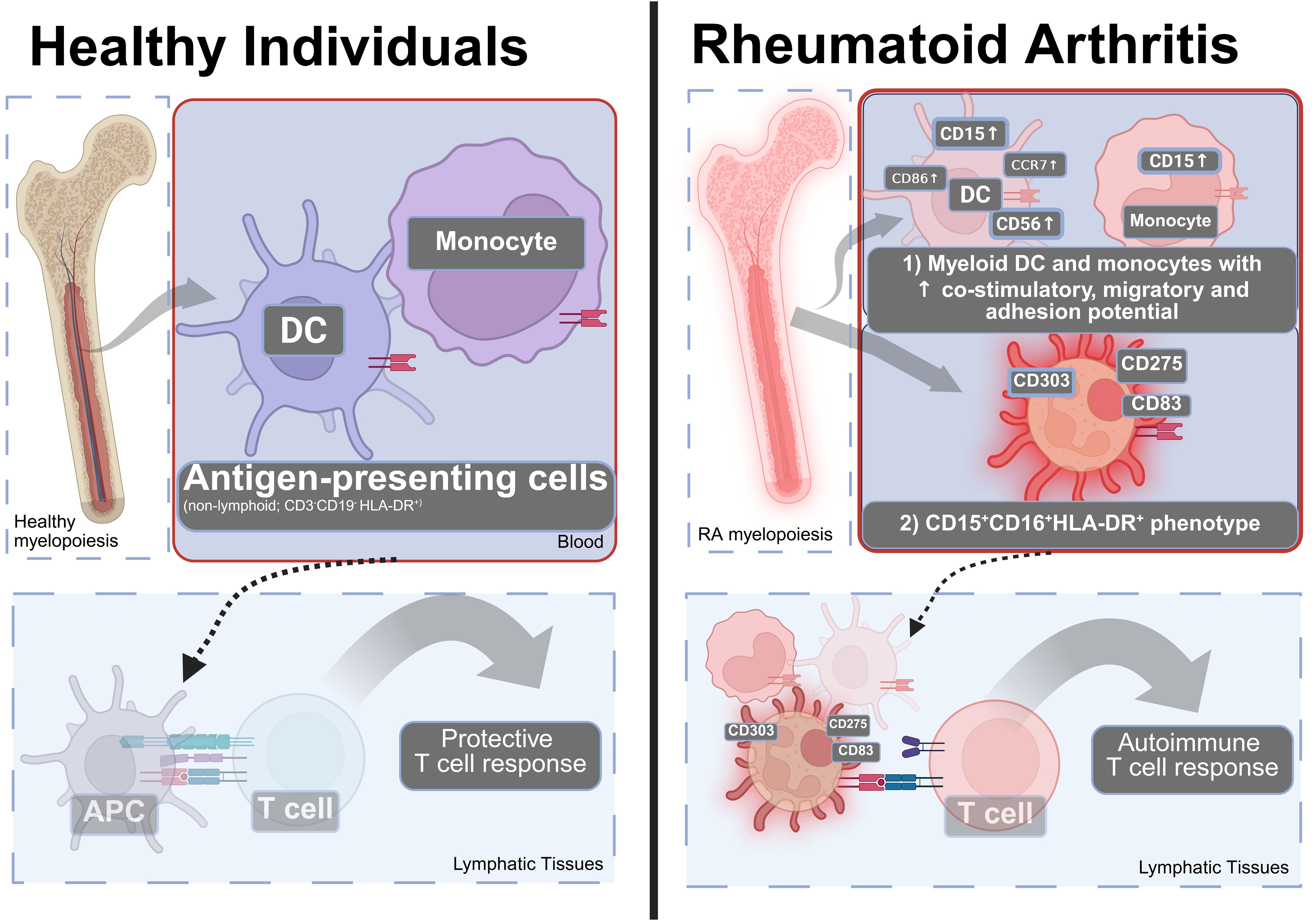 The image compares immune cell interactions in healthy individuals and those with rheumatoid arthritis. On the left, healthy myelopoiesis shows bone cross-section, antigen-presenting cells (DC and monocyte) in the blood, leading to a protective T cell response in lymphatic tissues. On the right, rheumatoid arthritis features altered myelopoiesis, presence of myeloid DC and monocytes with increased co-stimulatory, migratory, and adhesion potential, marked by specific phenotypes, leading to an autoimmune T cell response.