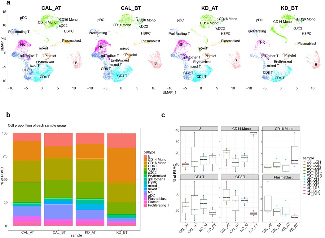 (a) UMAP plots of cell clusters labeled with cell types for samples CAL_AT, CAL_BT, KD_AT, and KD_BT, showing distinct clusters for each type. (b) Stacked bar chart indicating cell proportions for each sample group across various cell types. (c) Box plots displaying the percentage of different cell types, such as B cells, CD14 Mono, and CD16 Mono, in CAL and KD samples, with markers for different sample replicates.