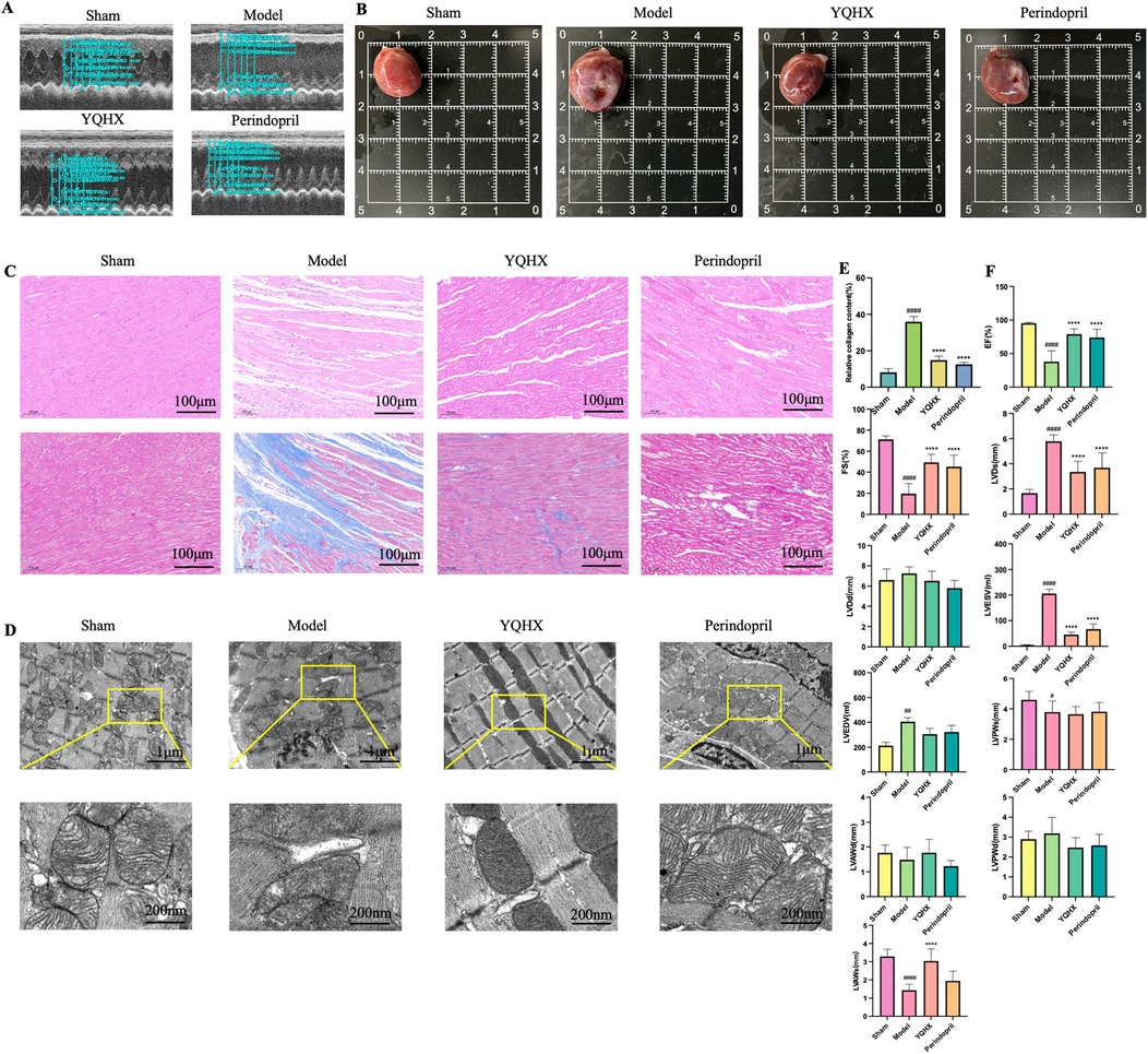 (A) Four echocardiography images labeled 'Sham,' 'Model,' 'YQHX,' and 'Perindopril.' (B) Four heart images on grid backgrounds with the same labels. (C) Histological heart tissue images, each labeled accordingly, with a scale of 100 micrometers. (D) Transmission electron microscopy images of heart tissues, with focus areas highlighted and dimensions provided. (E) and (F) Bar graphs showing quantitative data for various parameters across the four conditions.