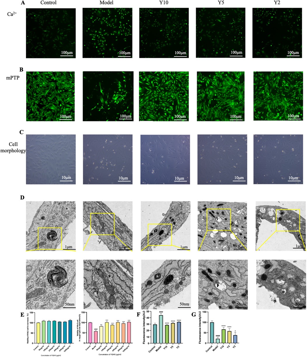 Panels depict various assays and analyses of biological samples. \n\nPanel A shows fluorescence images of calcium levels under control, model, and three treatments (Y10, Y5, Y2), with a scale bar of 100 micrometers.\n\nPanel B displays similar fluorescence images for mitochondrial permeability transition pore (mPTP), also with a 100 micrometer scale bar.\n\nPanel C presents cell morphology under the same conditions with a 10 micrometers scale bar. \n\nPanel D includes electron microscopy images showing detailed ultrastructure, with main and magnified views accompanied by 1 micrometer and 50 nanometers scale bars respectively.\n\nPanels E, F, and G are bar charts illustrating viability and fluorescence intensity data for control, model, and treatment groups.