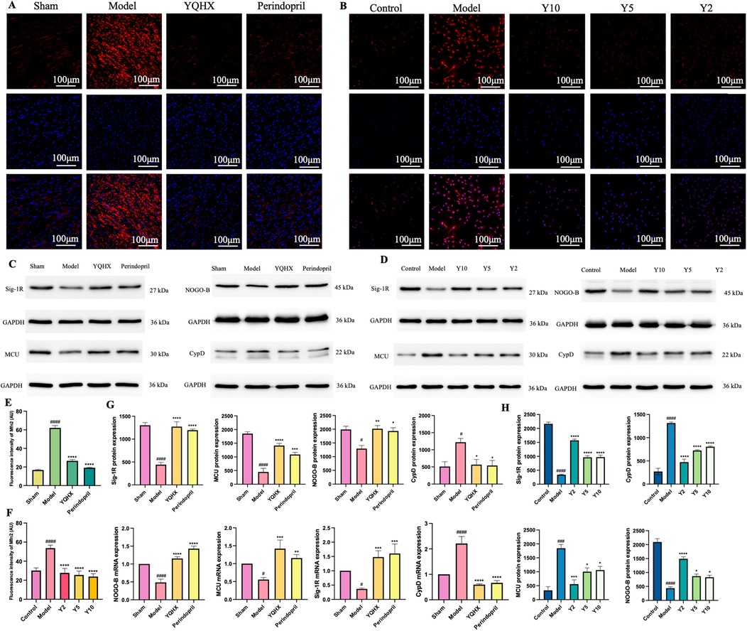 Fluorescence microscopy images and Western blot analyses in panels A and B show tissue samples treated with Sham, Model, YQHX, Perindopril, Control, Y10, Y5, and Y2 with scales of one hundred micrometers. Panels C and D display Western blot results for various proteins, including Sig-1R, NOGO-B, and GAPDH, with molecular weights specified. Graphs E to H illustrate quantitative data for protein and mRNA expression with statistical significance denoted by asterisks. Each panel provides comparative analysis of different treatments on protein expressions.