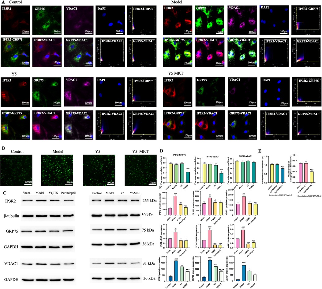 Panel A shows fluorescent images of cells under different conditions (Control, Model, Y5, Y5 MKT), stained for IP3R2, GRP75, VDAC1, and DAPI, along with merged and colocalization plots. Panel B presents four images of cells with green fluorescence under the same treatments. Panel C includes Western blot images showing expression levels of proteins such as IP3R2, GRP75, and VDAC1 across various conditions, aligned with protein markers. Panels D, E, and F display bar graphs presenting quantitative analysis of protein expression and concentration effects under different experimental conditions. Scale bars of 100 micrometers are present.