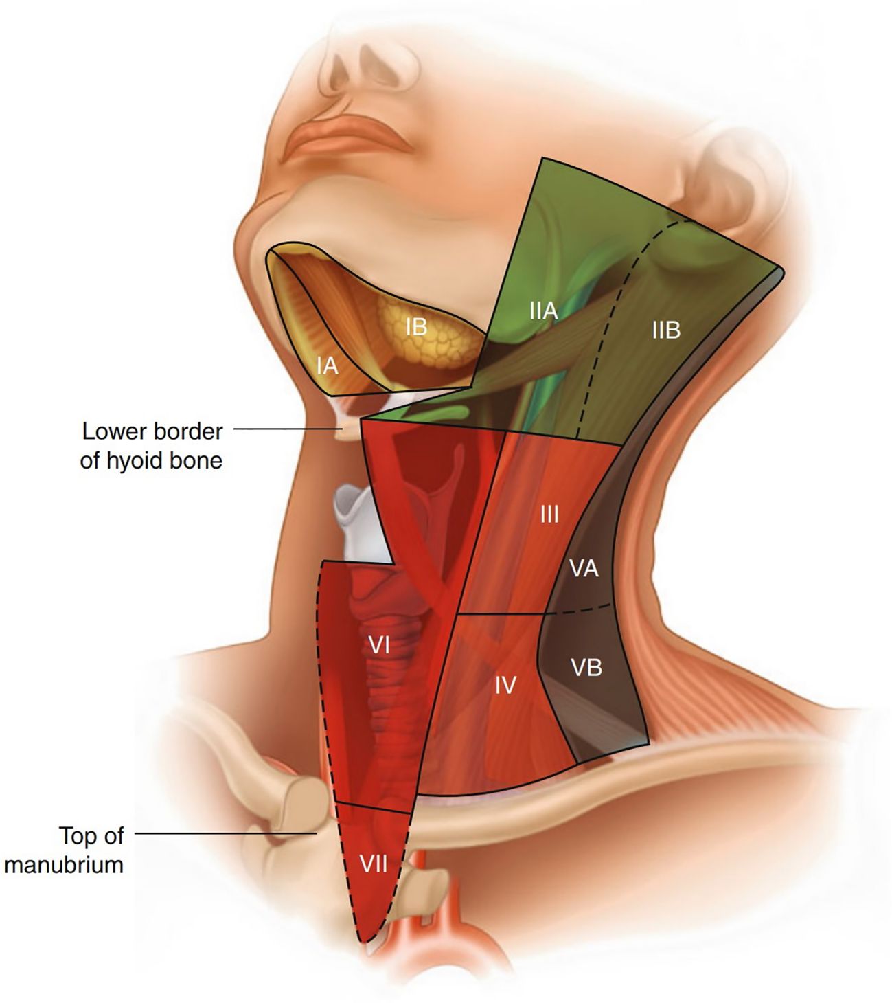 Medical illustration of the neck's lymph node levels, depicted in a sagittal view. Levels I to VII are marked, with areas IA and IB in the submandibular region. Levels II to V are shown laterally, with VI and VII centrally. Key landmarks, the lower border of the hyoid bone and top of the manubrium, are labeled.