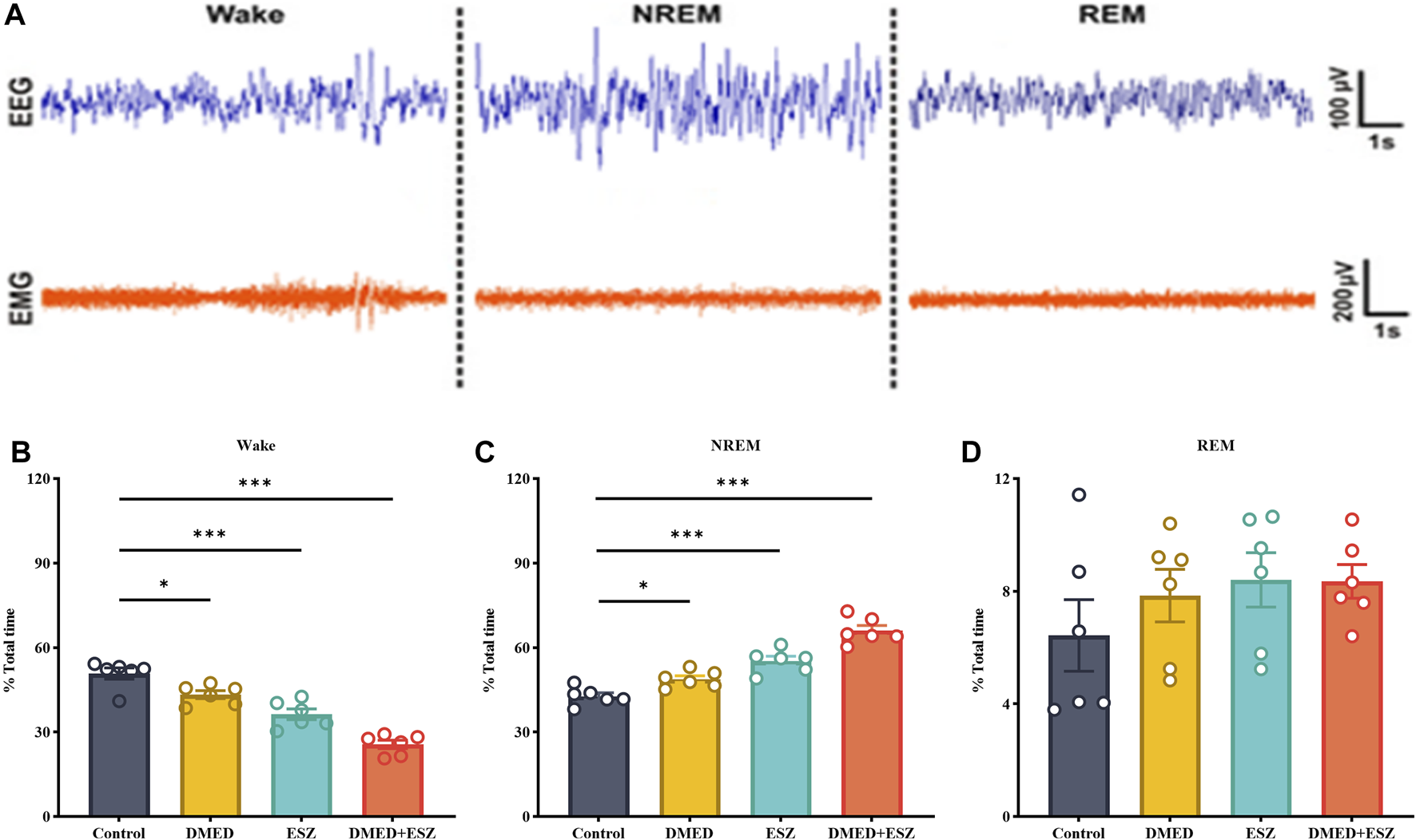 Graphical representation of sleep study data. Panel A shows EEG and EMG traces for wake, NREM, and REM stages. Panels B, C, and D are bar graphs showing the percentage of total time spent in wake, NREM, and REM stages respectively for different groups: Control, DMED, ESZ, and DMED+ESZ. Statistical significance is marked with asterisks.