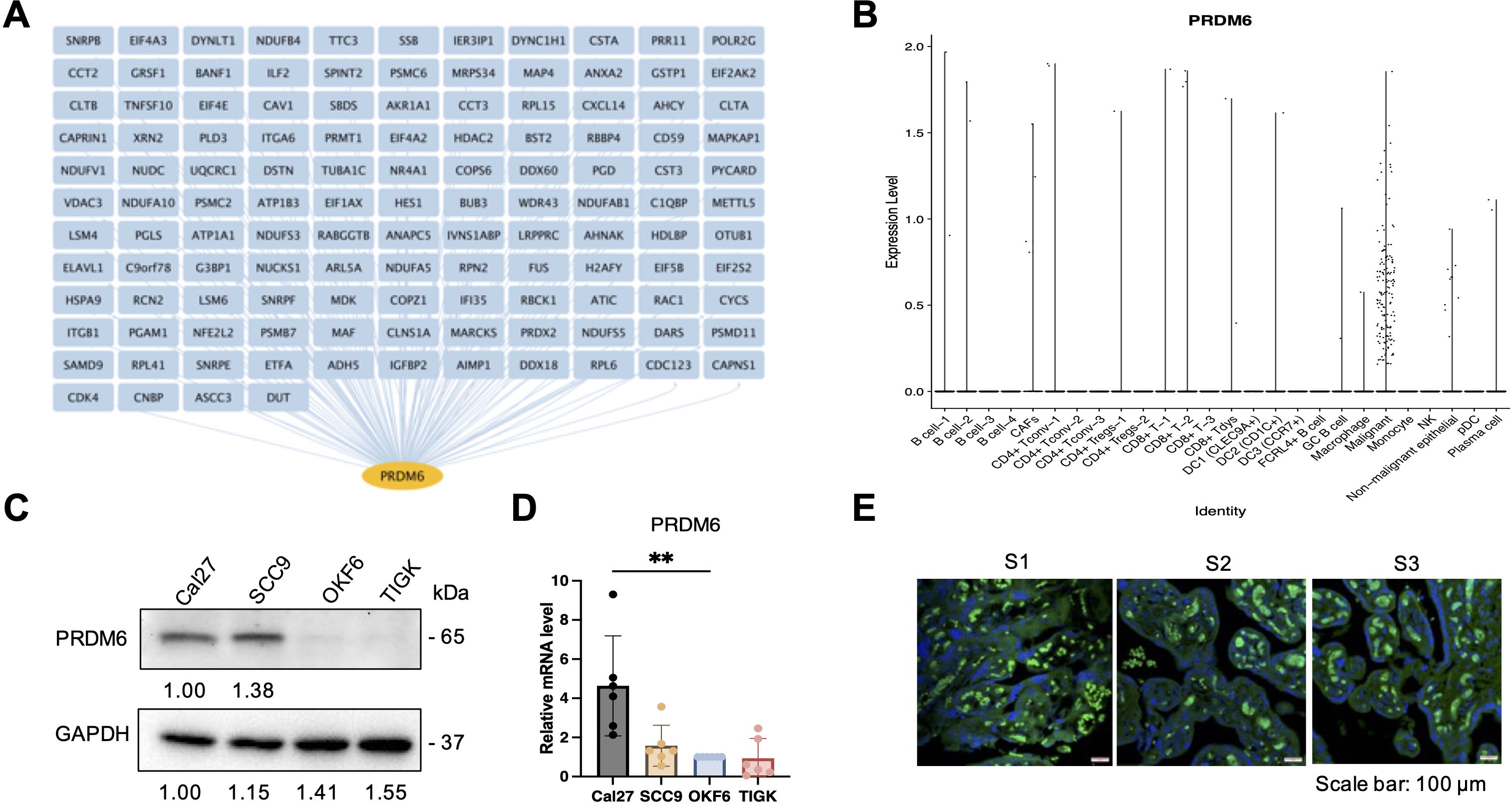 Diagram illustrating PRDM6 research data: (A) Network of IRG interacting with PRDM6. (B) Graph showing PRDM6 expression across various cell types, with identity on the x-axis and expression level on the y-axis. (C) Western blot displaying PRDM6 and GAPDH levels in cancer and non-cancer cell lines. (D) Bar chart of relative mRNA levels of PRDM6 in various cell lines, indicating significant differences. (E) Immunofluorescence images showing PRDM6 localization in cells across three samples, labeled S1 to S3, with a scale bar of 100 micrometers.