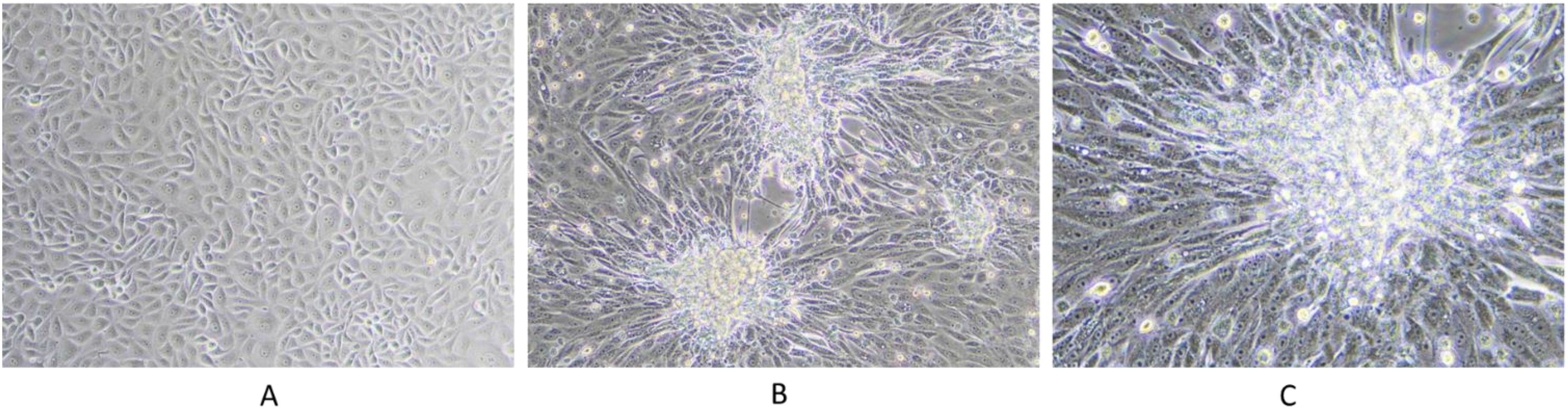Three-panel image showing MDBK cell line infected with LSDV under a microscope. Panel A depicts control cells without any LSDV virus. Panel B shows the formation of foci in MDBK cell lines infected by LSDV after 5 days post infection which is under 10x magnification. Panel C illustrates MDBK cell line infected with LSDV after 5 days post infection which is under 20X magnification.