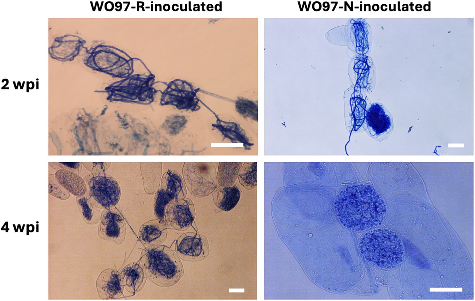 Microscopic images showing two types of inoculated samples (WO97-R and WO97-N) at two and four weeks post-inoculation (wpi). Both two-week images (top row) display filamentous structures stained blue. The four-week images (bottom row) show more developed and dense clusters of blue-stained structures. Each sample type exhibits distinct morphological characteristics at the respective time points.
