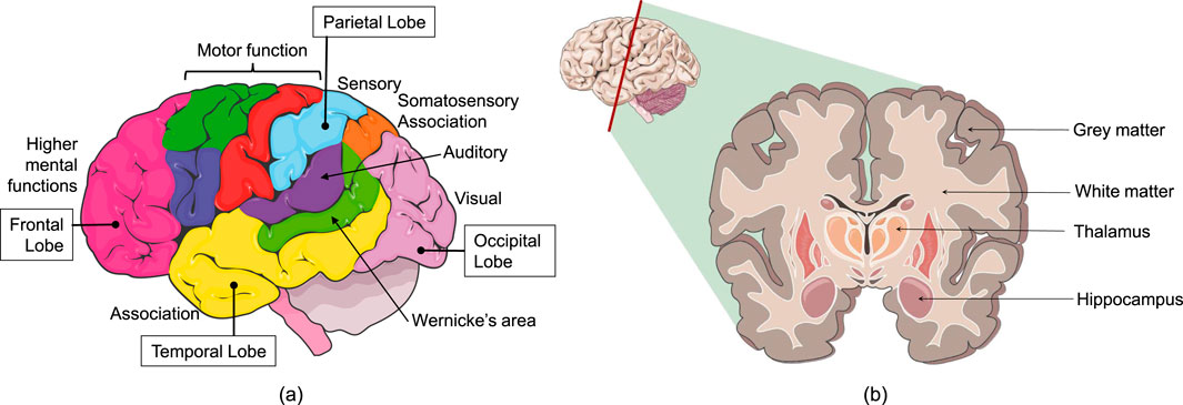 Illustration of the human brain with labeled regions. Left image shows the side view highlighting frontal, parietal, temporal, and occipital lobes, each associated with specific functions like motor, sensory, auditory, and visual. Right image shows a cross-section displaying internal structures including grey matter, white matter, thalamus, and hippocampus.