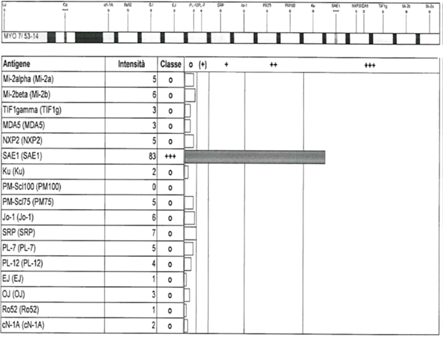 A table showing antigen test results. The antigens listed include Mi-2alpha, Mi-2beta, TIF1gamma, MDA5, NXP2, SAE1, Ku, PM-Scl100, PM-Scl75, Jo-1, SRP, PL-7, PL-12, EJ, OJ, Ro52, and cN-1A. Each antigen has corresponding intensity and class values. SAE1 shows the highest intensity at 83 with a class of +++.