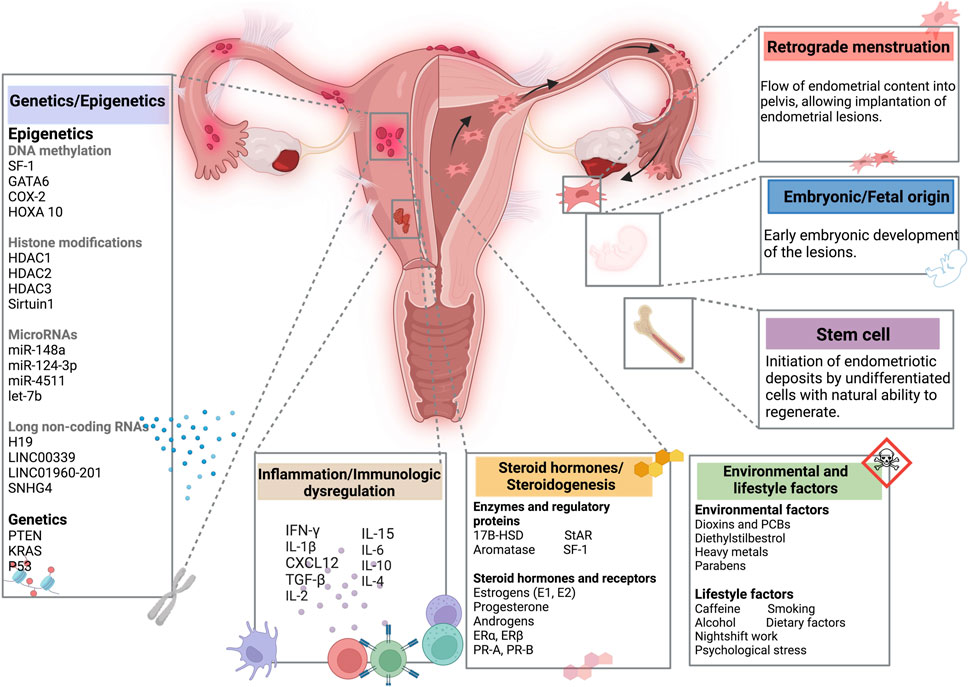 Diagram outlining various factors contributing to endometriosis. The central image of the female reproductive system highlights possible origins: retrograde menstruation, embryonic/fetal, and stem cell factors. Surrounding these are boxes detailing genetics/epigenetics, inflammation, immune dysregulation, steroid hormones, and lifestyle/environmental factors like smoking, alcohol, and stress. Specific genes, proteins, hormones, and external factors are listed, illustrating the complex interplay in the disease's development.