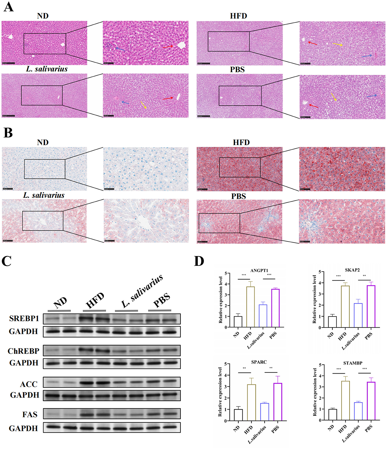 Panel A shows liver tissue histology with four conditions: ND, HFD, L. salivarius, and PBS, featuring inflammatory markers. Panel B displays lipid staining in liver tissues under the same conditions. Panel C contains Western blot analyses of SREBP1, ChREBP, ACC, and FAS with GAPDH as a control. Panel D presents bar charts of relative expression levels of ANGPT1, SKAP2, SPARC, and STAMBP across the conditions, highlighting significant differences.