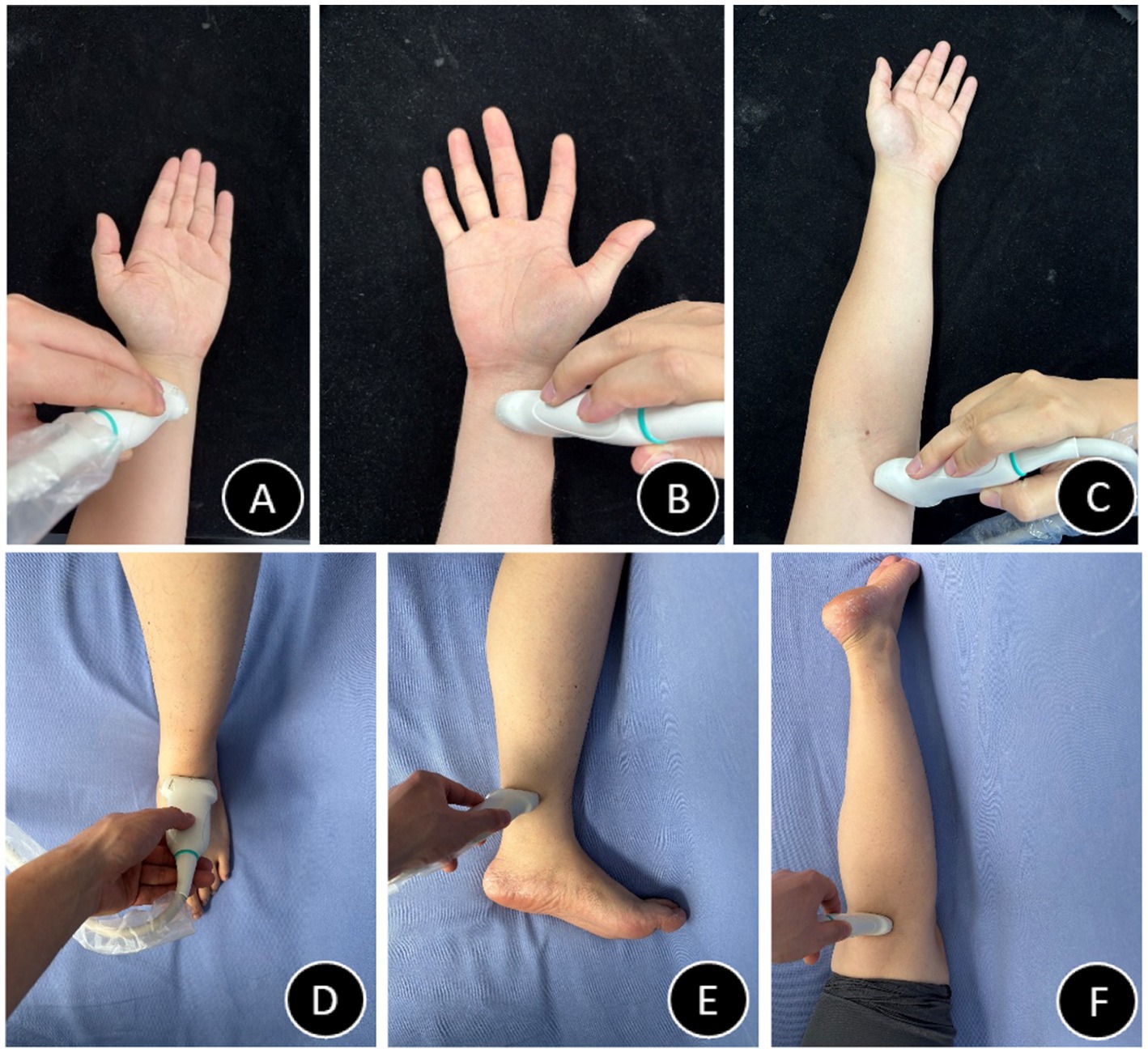 Six images labeled A to F show the use of a handheld ultrasound device on different parts of a person's body. A: Wrist palm side. B: Inside wrist. C: Upper arm. D: Outer thumb area. E: Inner ankle. F: Lower thigh. Each image illustrates precise application on a natural skin tone background.