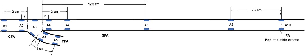 Diagram illustrating labeled points along the CFA, PFA, SFA, and PA, marked A1 to A10. Distances are given as a radius of the artery, with two centimeters and twelve and a half centimeters for points A1 to A8. The span between A9 and A10 is seven and a half centimeters, with A10 located at the level of the popliteal crease.