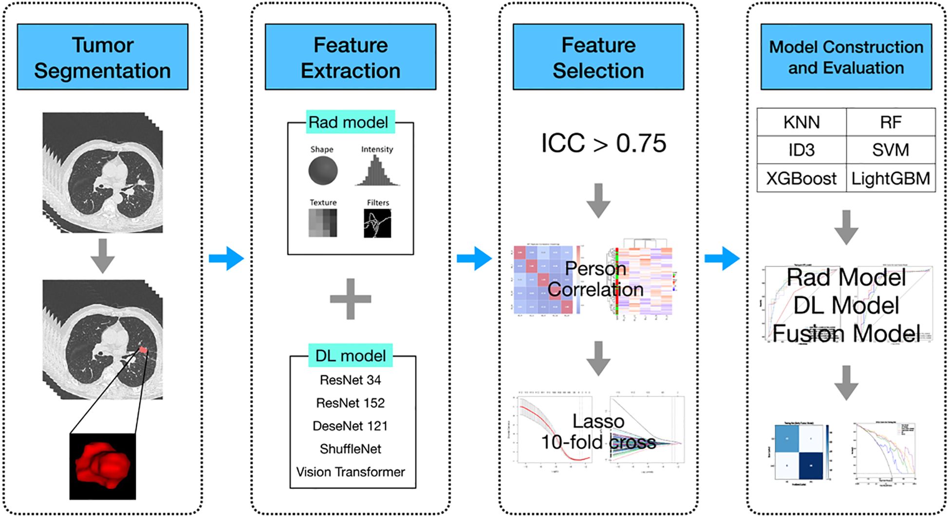 Diagram depicting a four-step process for tumor analysis and model evaluation. Step 1: Tumor segmentation displayed with CT scans. Step 2: Feature extraction using Rad and DL models, identifying shape, intensity, texture, and filters. Step 3: Feature selection with a correlation matrix, applying Pearson correlation and Lasso cross-validation. Step 4: Model construction and evaluation using various algorithms like KNN, RF, SVM, XGBoost, and LightGBM, leading to graph outcomes for Rad, DL, and fusion models.