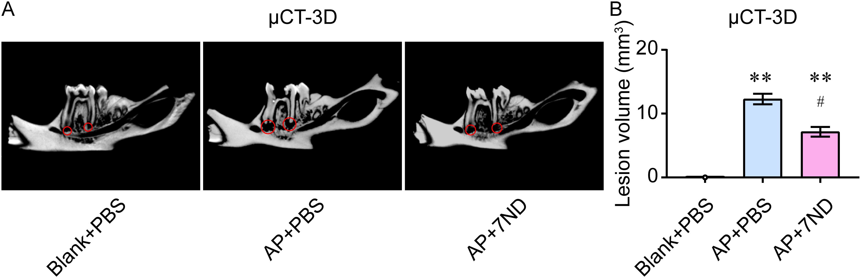 Three micro-CT 3D images of a rat jaw, each labeled “Blank+PBS,” “AP+PBS,” and “AP+7ND,” showing lesion areas circled in red. A corresponding bar chart displays lesion volume in cubic millimeters. Bars for “AP+PBS” and “AP+7ND” are significantly higher compared to “Blank+PBS,” with “AP+7ND” having a lower volume than “AP+PBS.” Statistical significance is indicated with asterisks and hash symbols.