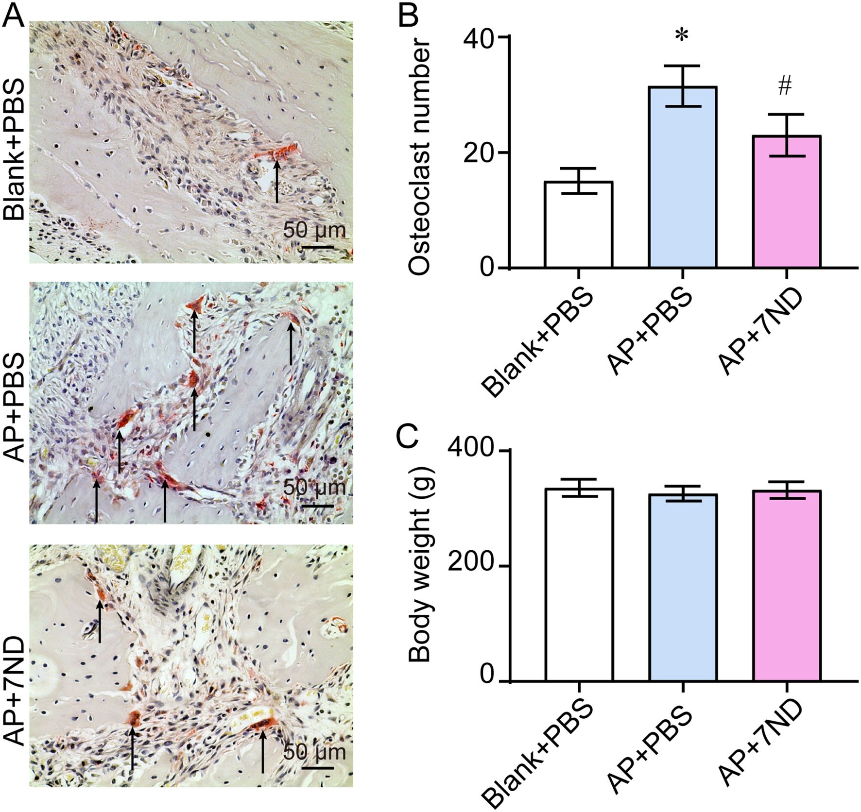 Panel A shows histological images with arrows indicating osteoclasts in various treatments: Blank+PBS, AP+PBS, and AP+7ND, each with a scale bar of fifty micrometers. Panel B presents a bar graph of osteoclast numbers, showing an increase in AP+PBS compared to Blank+PBS, with AP+7ND showing reduced osteoclast numbers. Panel C displays body weight bar graphs, indicating similar weights across all treatments: Blank+PBS, AP+PBS, and AP+7ND.
