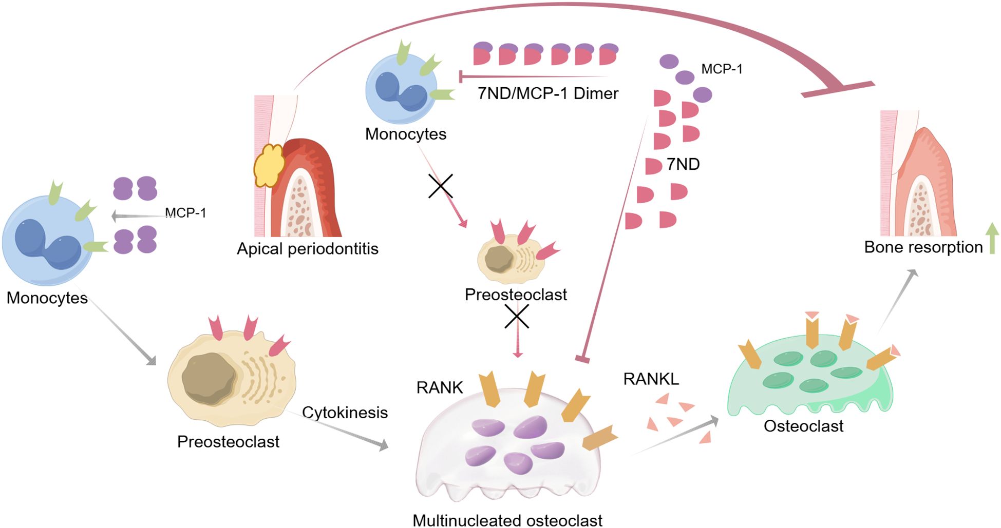 Diagram illustrating the process of apical periodontitis involving monocytes converting to preosteoclasts, influenced by MCP-1. 7ND inhibits this process. Preosteoclasts become multinucleated osteoclasts through cytokinesis and RANK/RANKL interaction, leading to bone resorption.
