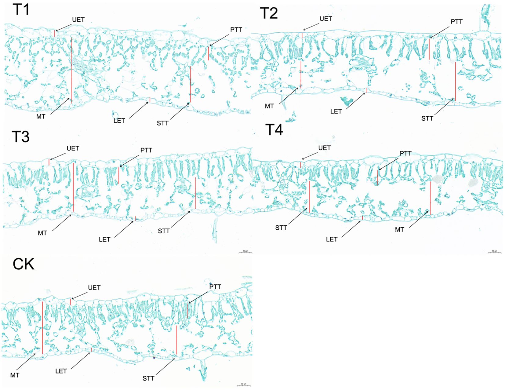 Cross-sections of plant tissue labeled T1 to T4 and CK, showing different layers marked with red lines and annotations. Layers include UET, PTT, MT, LET, and STT in various configurations, with sections displaying cellular structures in light blue against a white background.