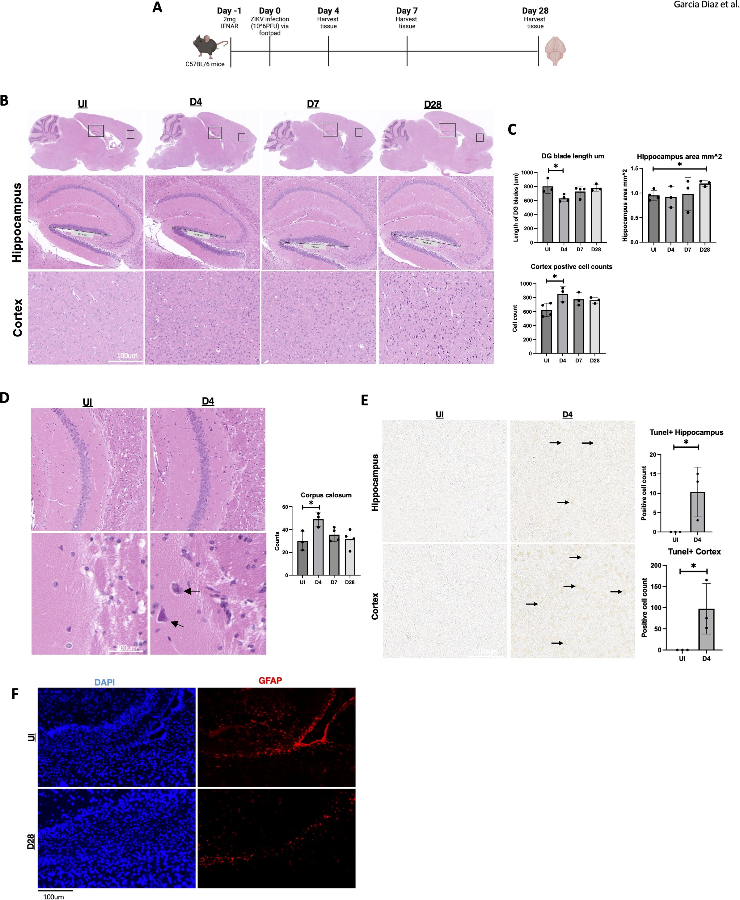 Diagram detailing the effects of ZIKV infection in C57BL/6 mice over a 28-day period. Panels include a timeline of infection and tissue harvest, histological images of hippocampus and cortex, graphs showing various measurements like DG blade length, hippocampus area, and cortex cell counts, and immunohistochemical analysis indicating changes in cell structures. Comparisons are drawn between uninfected controls and different days post-infection, highlighting cell alterations. Additional graphs, images, and fluorescence microscopy with DAPI and GFAP staining illustrate cellular differences at the final time points.