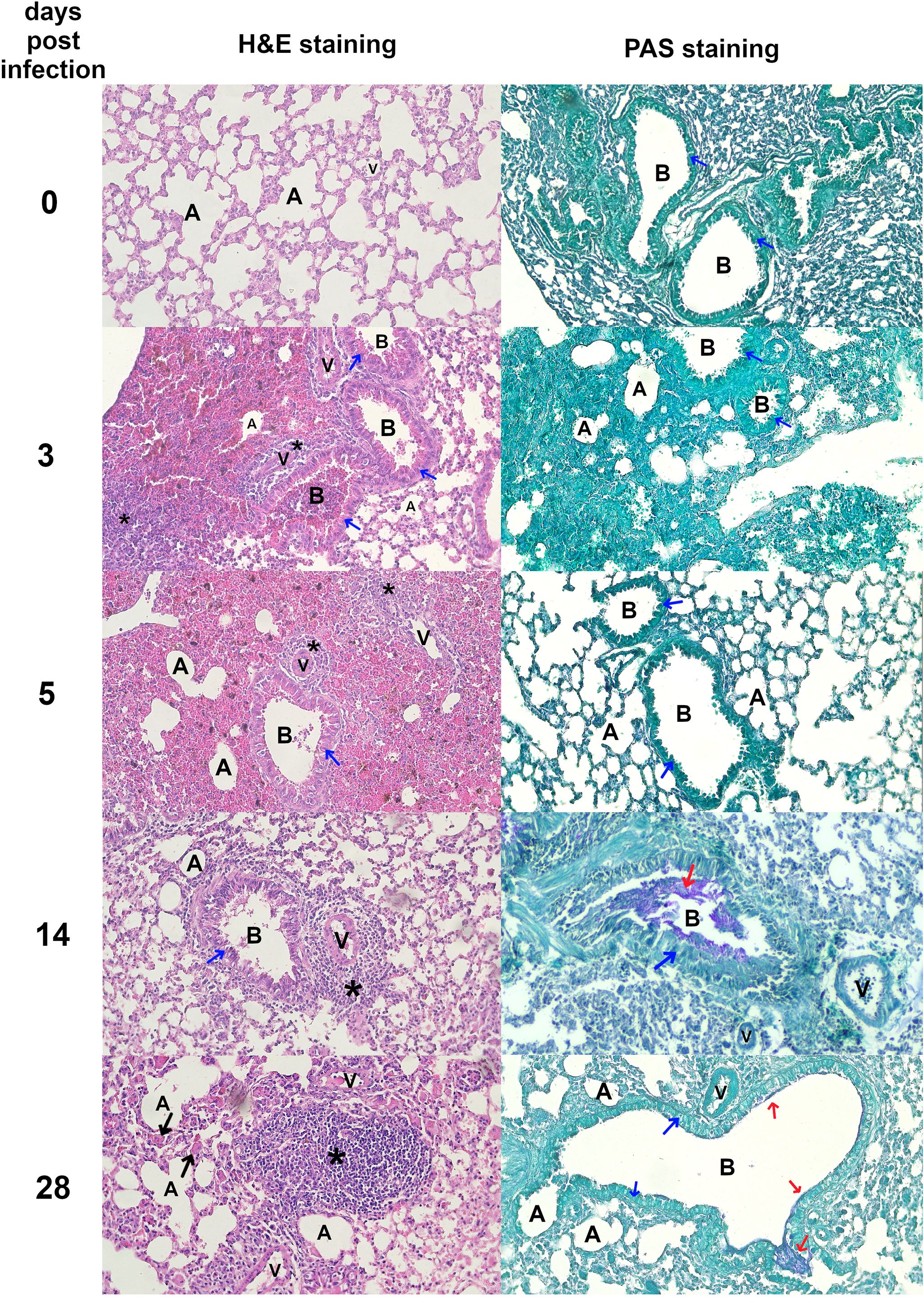 Histological comparison of lung tissue at different days post-infection using H&E and PAS staining. H&E column shows varying cellular density and structural changes from day zero to twenty-eight. PAS column highlights mucus presence. Labels “A”, “B”, “V”, and arrows indicate specific anatomical features and changes over time.