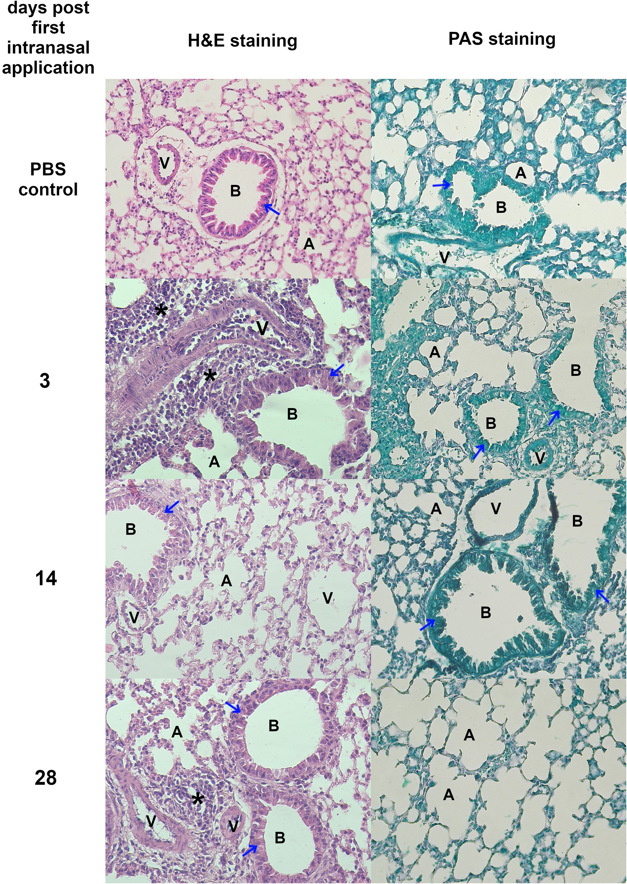 Histological comparison of lung tissue after intranasal application. Panels show H&E and PAS-stained sections at PBS control, 3 days, 14 days, and 28 days post-application. Blue arrows indicate tissue changes; stars highlight cellular infiltration. “A” denotes alveoli, “B” bronchioles, and “V” vessels.