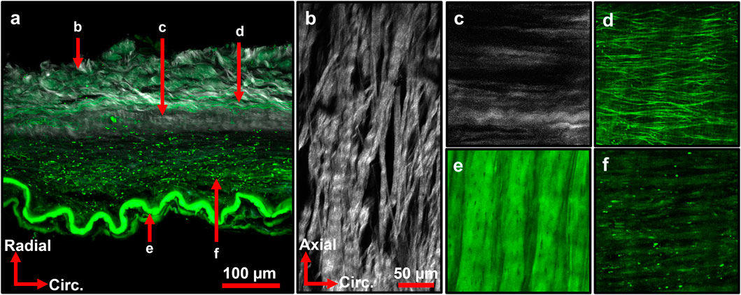 Microscopic images displaying various sections of tissue labeled a to f. Panel a shows a cross-section with red arrows indicating specific layers. Panels b to f highlight different microstructural features and colors under microscopic magnification, including grayscale and green fluorescence images. Axes indicate different orientations as radial, circumferential, and axial, with scale bars of one hundred and fifty micrometers.