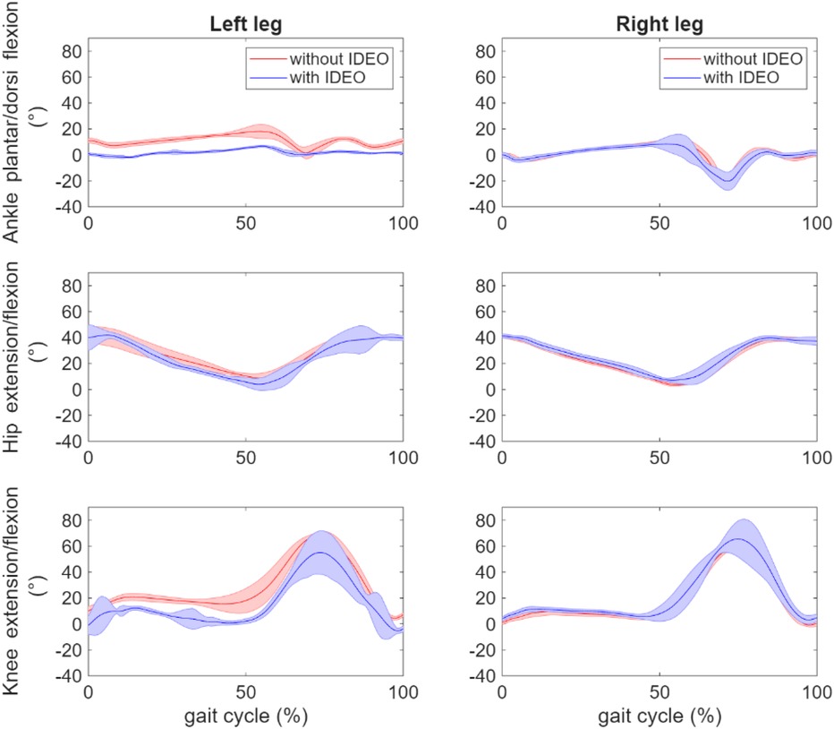 Graphs depict ankle, hip, and knee flexion/extension for left and right legs during gait cycles. They compare movements with and without IDEO. Red line represents without IDEO, and blue represents with IDEO, showing variations in movement across the gait cycle.