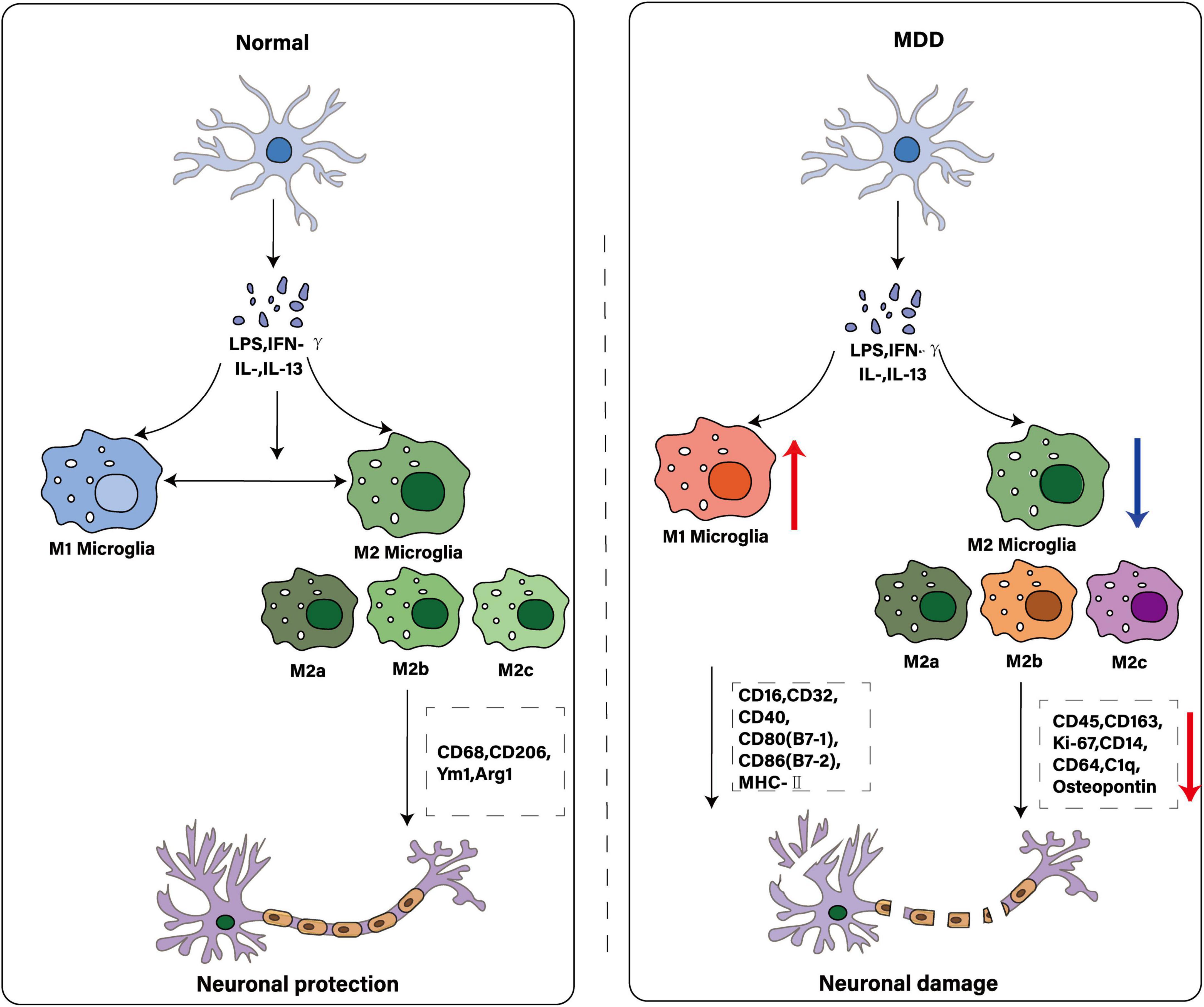 Diagram showing microglial activation in normal and major depressive disorder (MDD) conditions. On the left, normal conditions display balanced M1 and M2 microglia, promoting neuronal protection. On the right, MDD shows increased M1 microglia and decreased M2 microglia with subtypes M2a, M2b, and M2c, leading to neuronal damage. Key markers like CD68, CD206, and Arg1 are highlighted in normal conditions, while markers like CD16, CD32, and CD86 are noted in MDD.