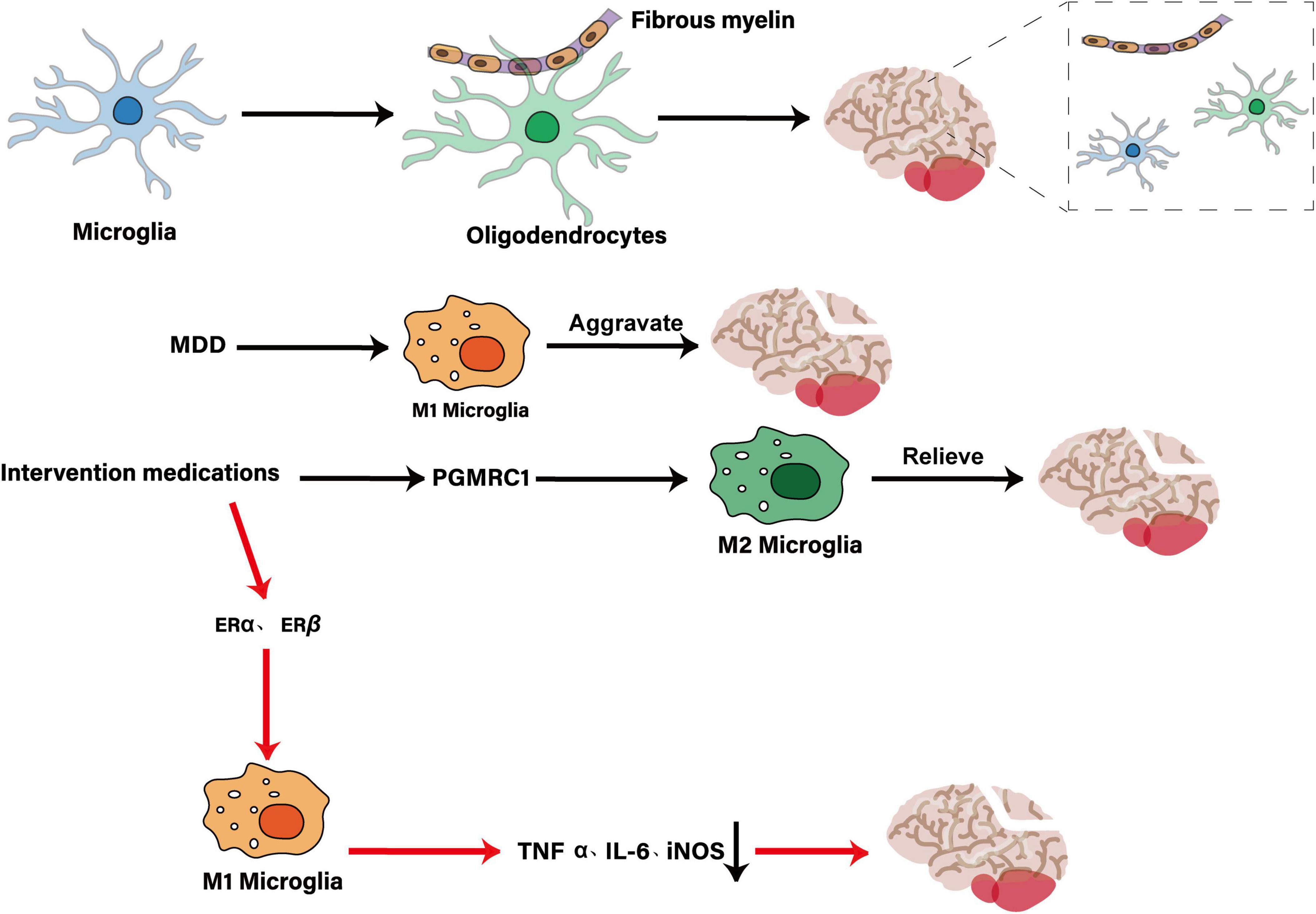Diagram showing the role of microglia in brain health. Microglia transform into oligodendrocytes forming fibrous myelin. In major depressive disorder (MDD), M1 microglia aggravate the condition. Conversely, M2 microglia, influenced by medications via PGMRC1, relieve symptoms. Medications act on M1 microglia through ERα and ERβ pathways to reduce TNF α, IL-6, and iNOS, mitigating brain deterioration.