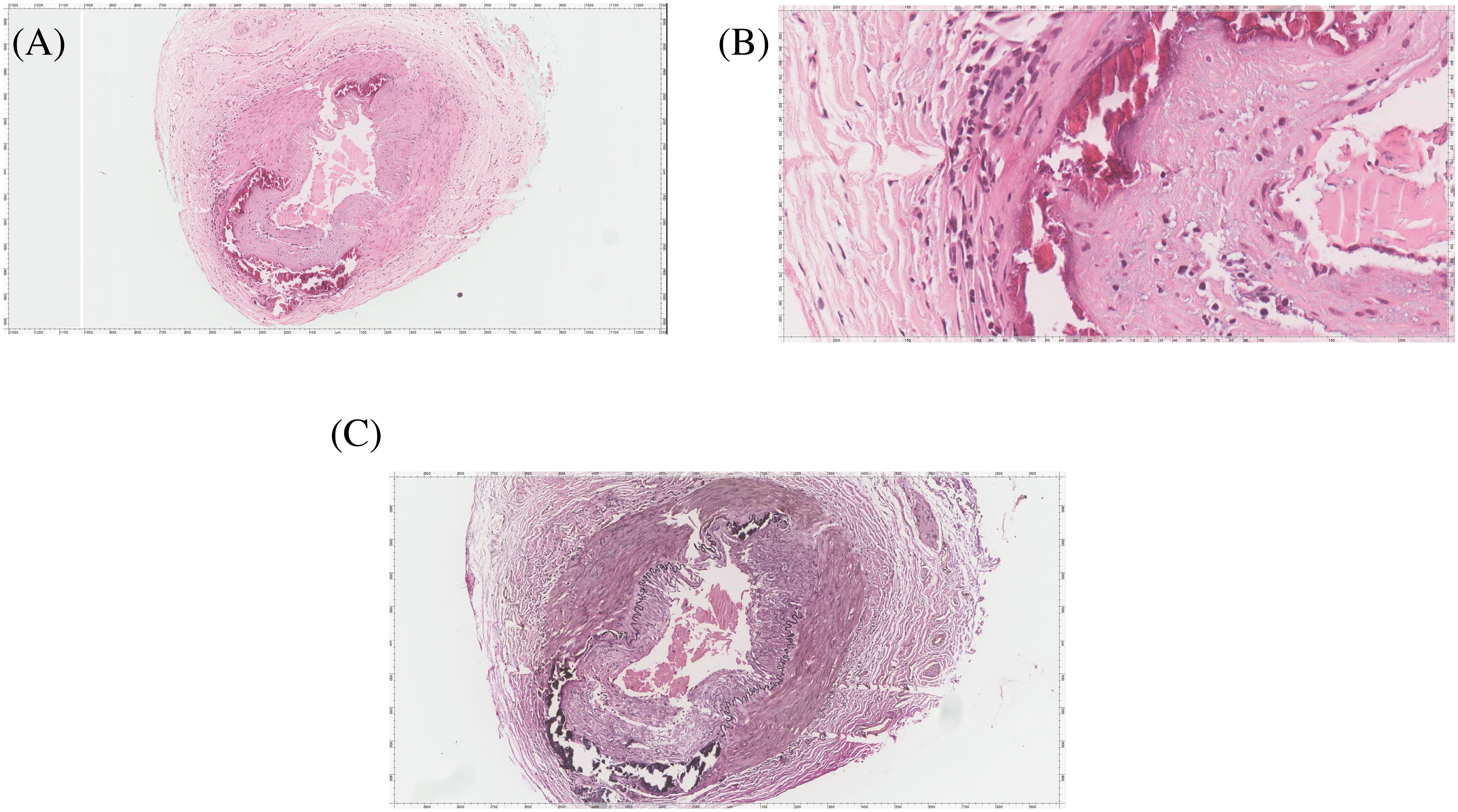 Histological images of blood vessels with three panels labeled A, B, and C demonstrating varying features. Panel A shows a cross-section with a central lumen surrounded by pink-stained tissue. Panel B provides a close-up of fibrous tissue with visible cellular structures. Panel C depicts a cross-section similar to A but with denser tissue staining.