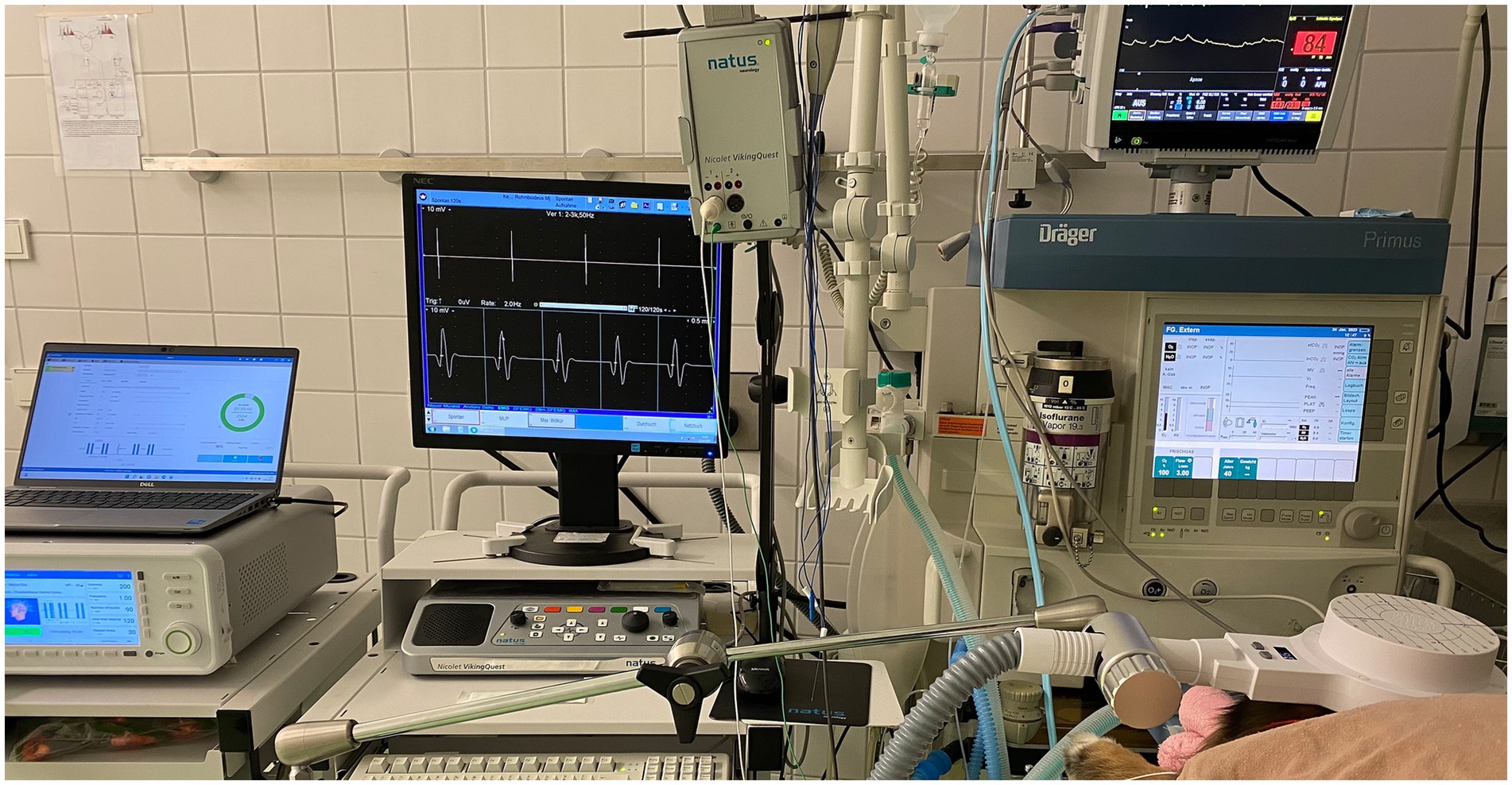 Medical monitoring equipment in a hospital setting, including computers with screens displaying vital signs, ECG patterns, and patient data. Devices and wires are connected, indicating active patient monitoring. The environment is sterile and clinical.