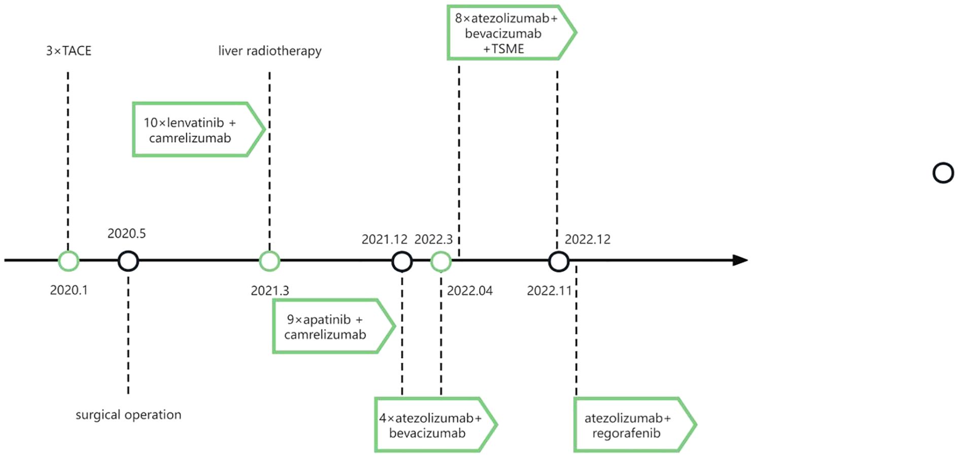 Timeline depicting various treatments and events from 2020 to 2022. Key events include a surgical operation in January 2020, three TACE treatments, liver radiotherapy, multiple drug treatments such as lenvatinib with camrelizumab, apatinib with camrelizumab, atezolizumab with bevacizumab, and atezolizumab with regorafenib. Dates for these events range from January 2020 to December 2022.