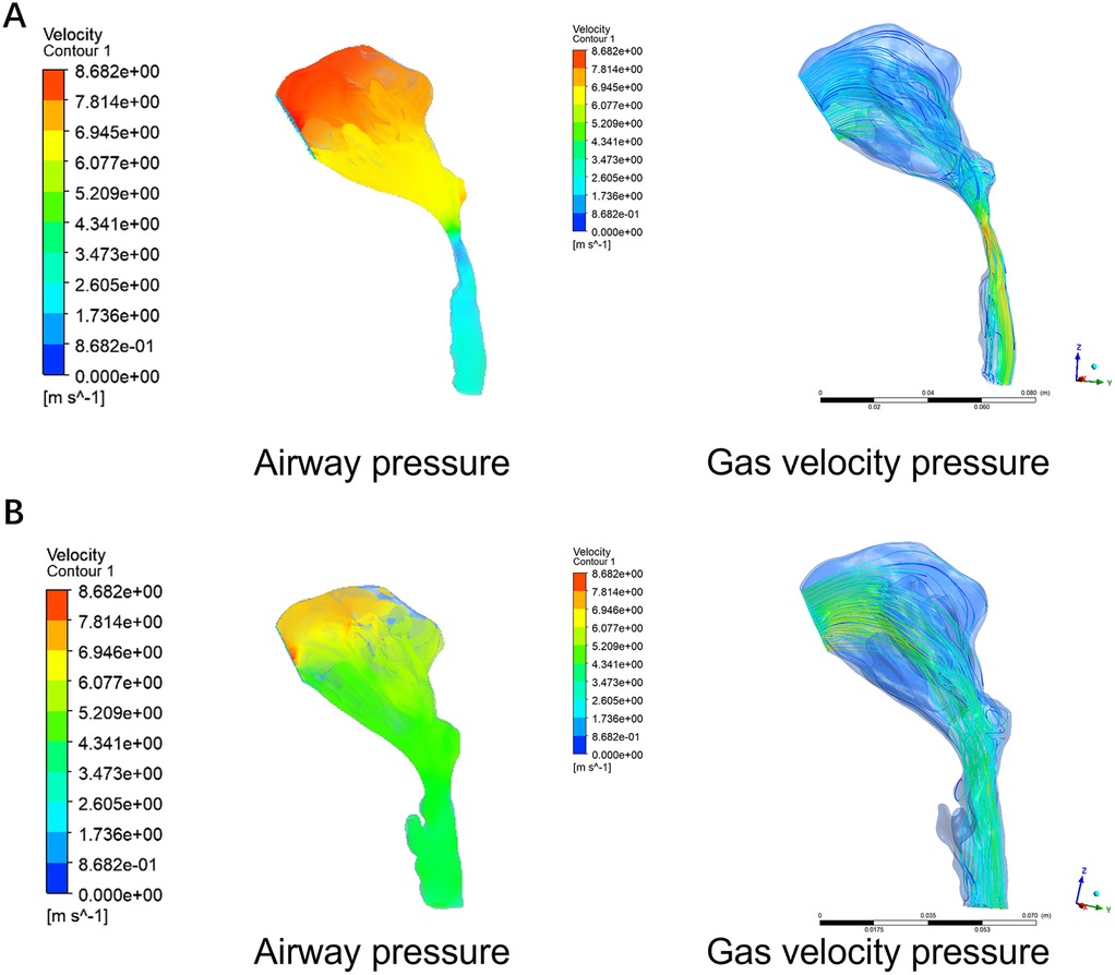 Two sets of color-coded contour maps labeled A and B, displaying airway pressure and gas velocity pressure. Each set has two panels: the left shows airway pressure with colors ranging from red to blue indicating velocity, while the right displays fluid motion lines for gas velocity pressure. Both include velocity scales in meters per second.
