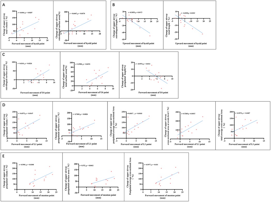 A series of scatter plots labeled A to E analyze the correlation between the movement of different anatomical points (hyoid, U6, L1, and menton) in millimeters and the percentage change in upper airway parameters, such as oropharyngeal volume and total airway volume. Each plot displays data points with a trend line and correlation coefficients (r-values) with p-values, showing varying degrees of positive or negative correlation.