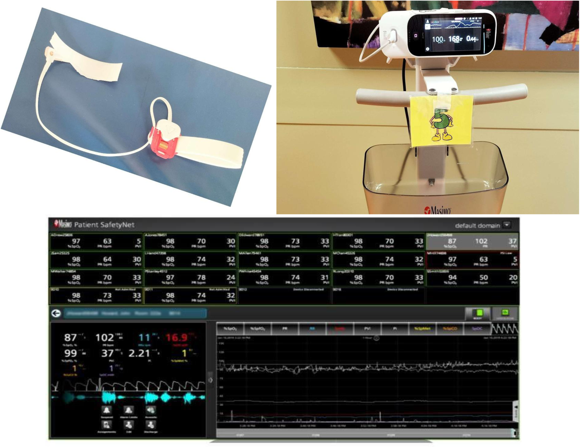 Medical equipment display, including a finger sensor, a monitor stand with a screen showing health metrics, and a large display screen with patient data such as heart rate and blood oxygen levels.