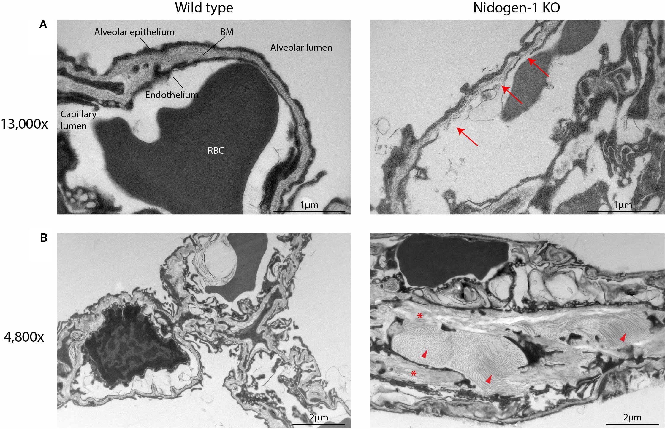 (A) Electron micrographs comparing lung tissue structures at 13,000x magnification. The wild-type sample shows well-defined alveolar epithelium, basement membrane (BM), endothelium, capillary lumen, and red blood cells (RBC). The Nidogen-1 KO sample shows structural alterations indicated by red arrows. (B) Electron micrographs at 4,800x magnification. The wild-type sample displays normal lung tissue architecture. The Nidogen-1 KO sample reveals marked structural changes, highlighted by red asterisks and arrowheads, indicating alterations in tissue organization.