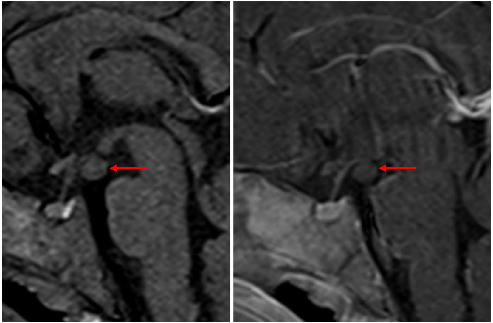 MRI scans showing sagittal views of the brain with red arrows pointing to specific areas. The images indicate regions of interest for medical examination or analysis.