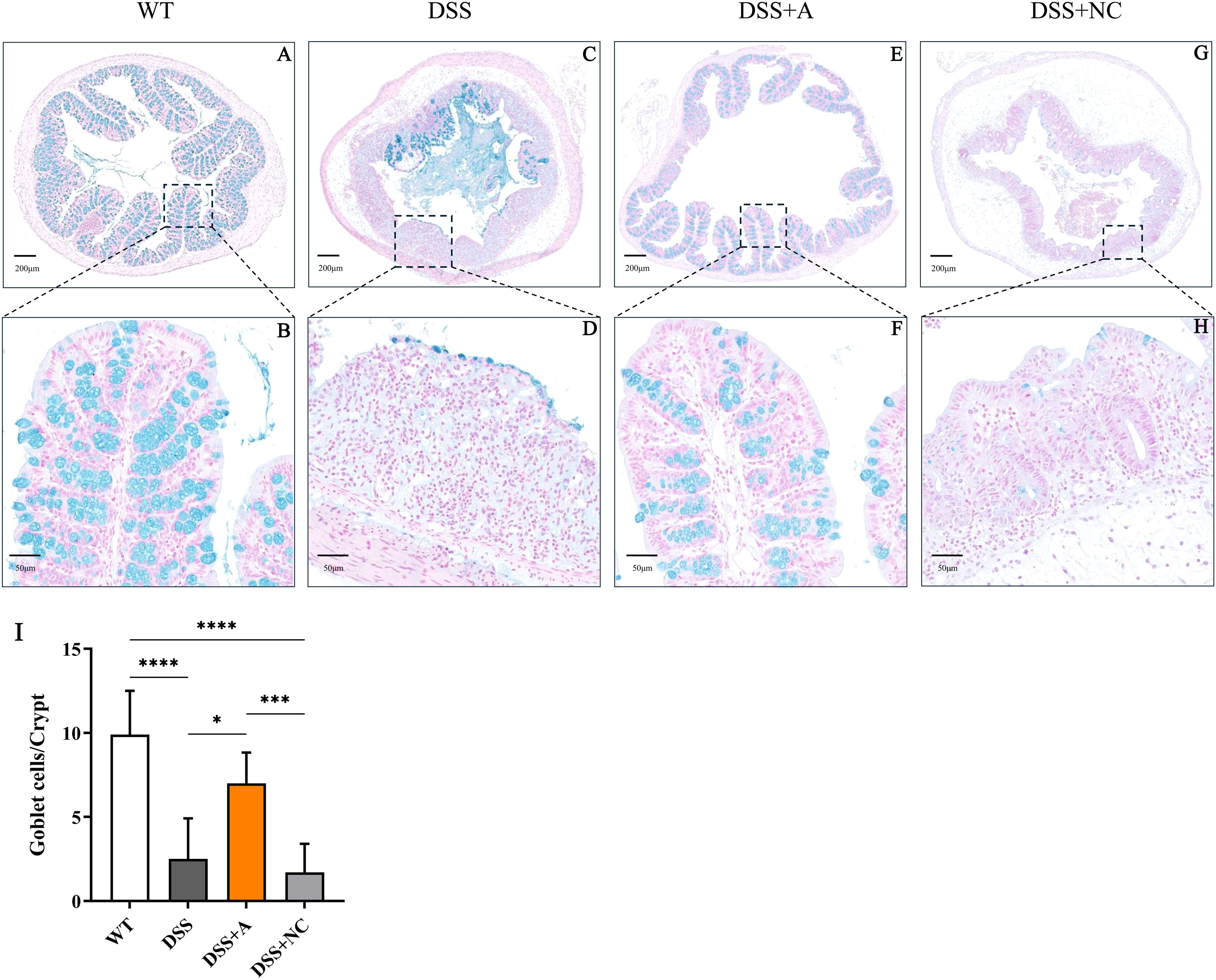 Microscopic images of colon tissue stained to highlight goblet cells in four conditions: WT (A, B), DSS (C, D), DSS+A (E, F), DSS+NC (G, H). Images A, C, E, and G show overall tissue structures, while B, D, F, and H provide detailed views of the crypts. The accompanying bar chart (I) compares goblet cell counts per crypt across conditions, with WT showing the highest count and DSS+NC the lowest. Significant differences are indicated by asterisks.