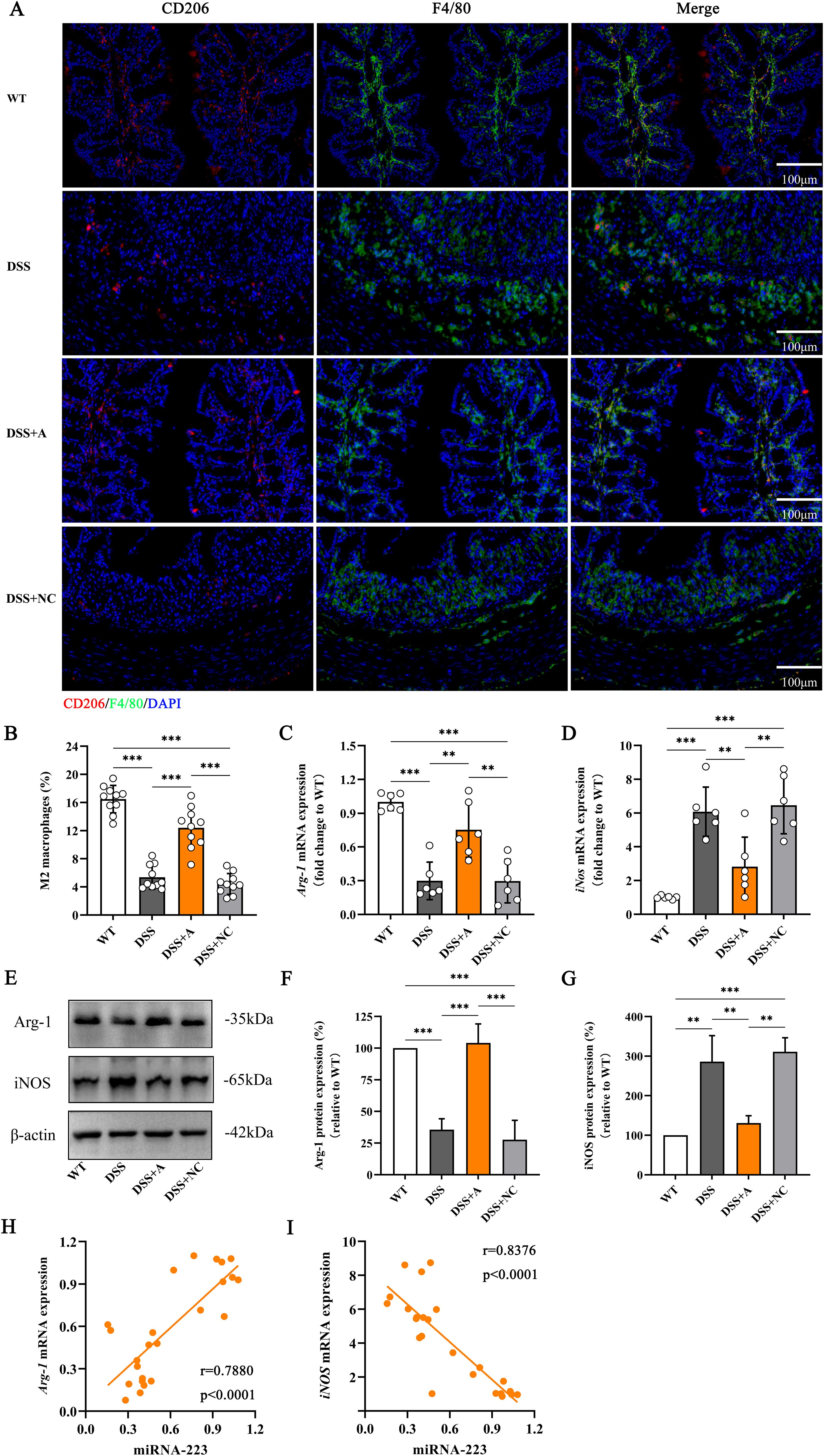 Fluorescent microscopy images and graphs depict the expression of CD206, F4/80, and DAPI across different conditions (WT, DSS, DSS+A, DSS+NC) in panel A. Panels B-D show bar graphs of M2 macrophages and mRNA expression levels of Arg-1 and iNOS, with statistical significance indicated. Panel E presents protein expression through Western blots. Panels F-G display bar graphs of Arg-1 and iNOS protein expression. Panels H-I contain scatter plots correlating miRNA-223 with Arg-1 and iNOS mRNA expression, showing significant correlations. Scale bars represent 100 µm.