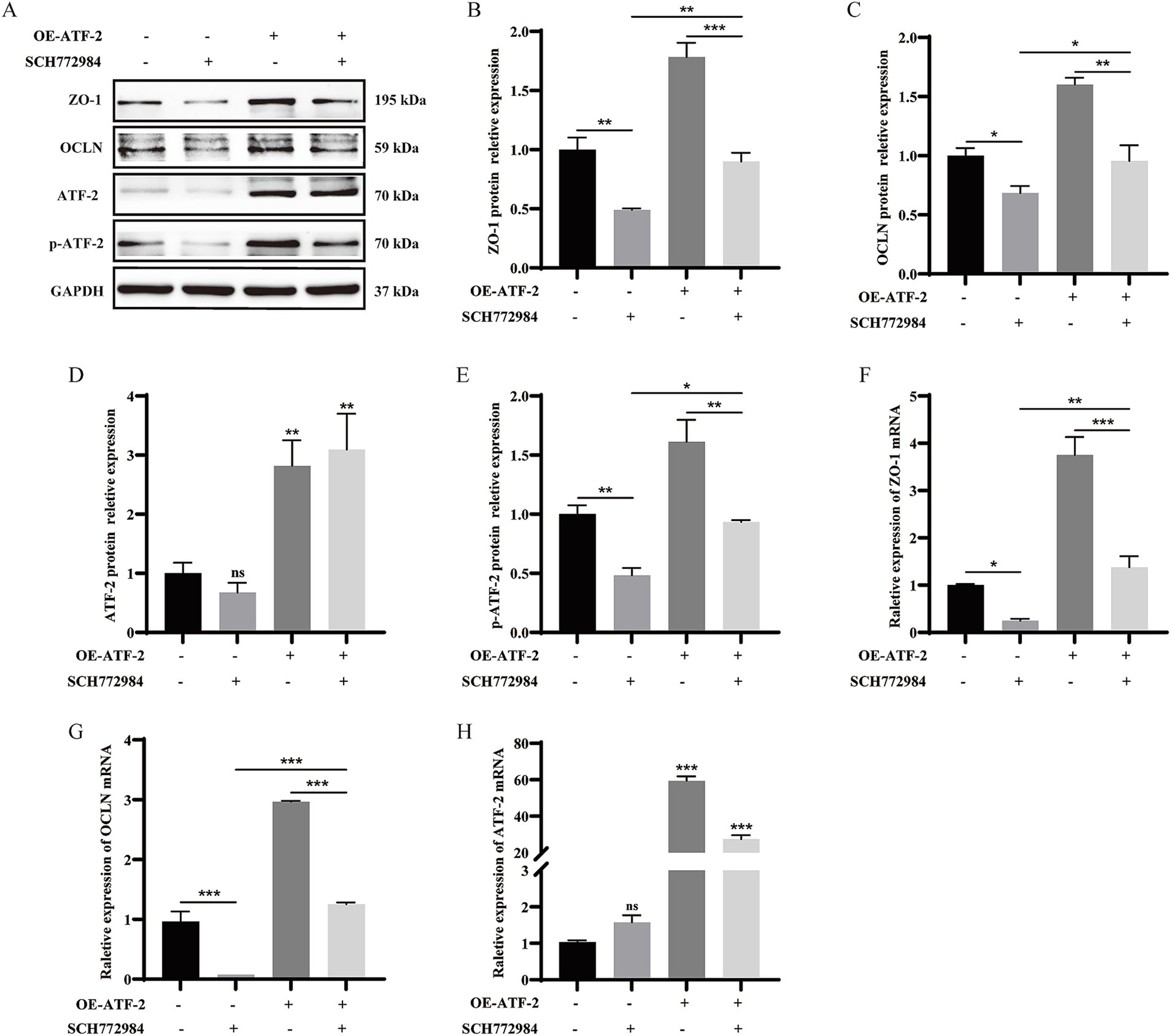 Western blot and bar graphs showing the effects of OE-ATF-2 and SCH772984 on protein and mRNA expressions. Panel A displays protein bands for ZO-1, OCLN, ATF-2, p-ATF-2, and GAPDH under different conditions. Panels B to E and G to H present bar graphs quantifying the relative expression levels of ZO-1, OCLN, ATF-2, p-ATF-2 proteins, and ZO-1 and ATF-2 mRNA. Individual bars indicate different combinations of OE-ATF-2 and SCH772984 presence, highlighting statistically significant differences with asterisks.