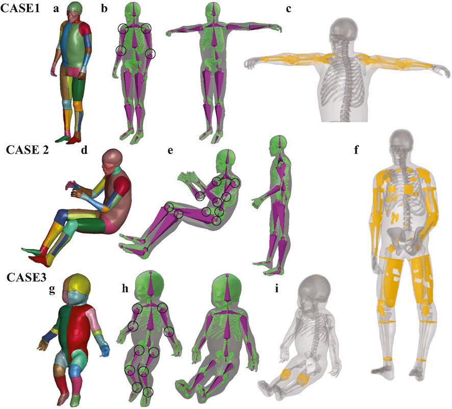 Three cases show human body models. Case 1 (a-c) and Case 2 (d-f) display adult models in different poses, with colored sections for muscles, skeletons, and joints. Case 3 (g-i) involves a child model, similarly sectioned and posed. Skeletons are highlighted in transparent orange in some images.