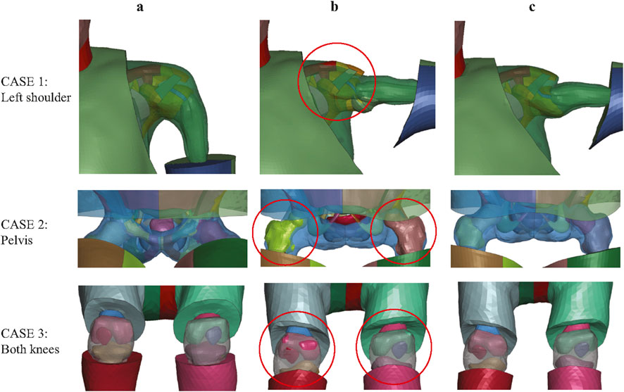 Three rows of colored 3D anatomical models illustrate different joint case scenarios. Case 1: Shows the left shoulder in three views, with a red circle highlighting structural details. Case 2: Displays the pelvis with joint sections circled. Case 3: Depicts both knees, highlighting joint areas. Each column corresponds to different angles labeled a, b, and c.