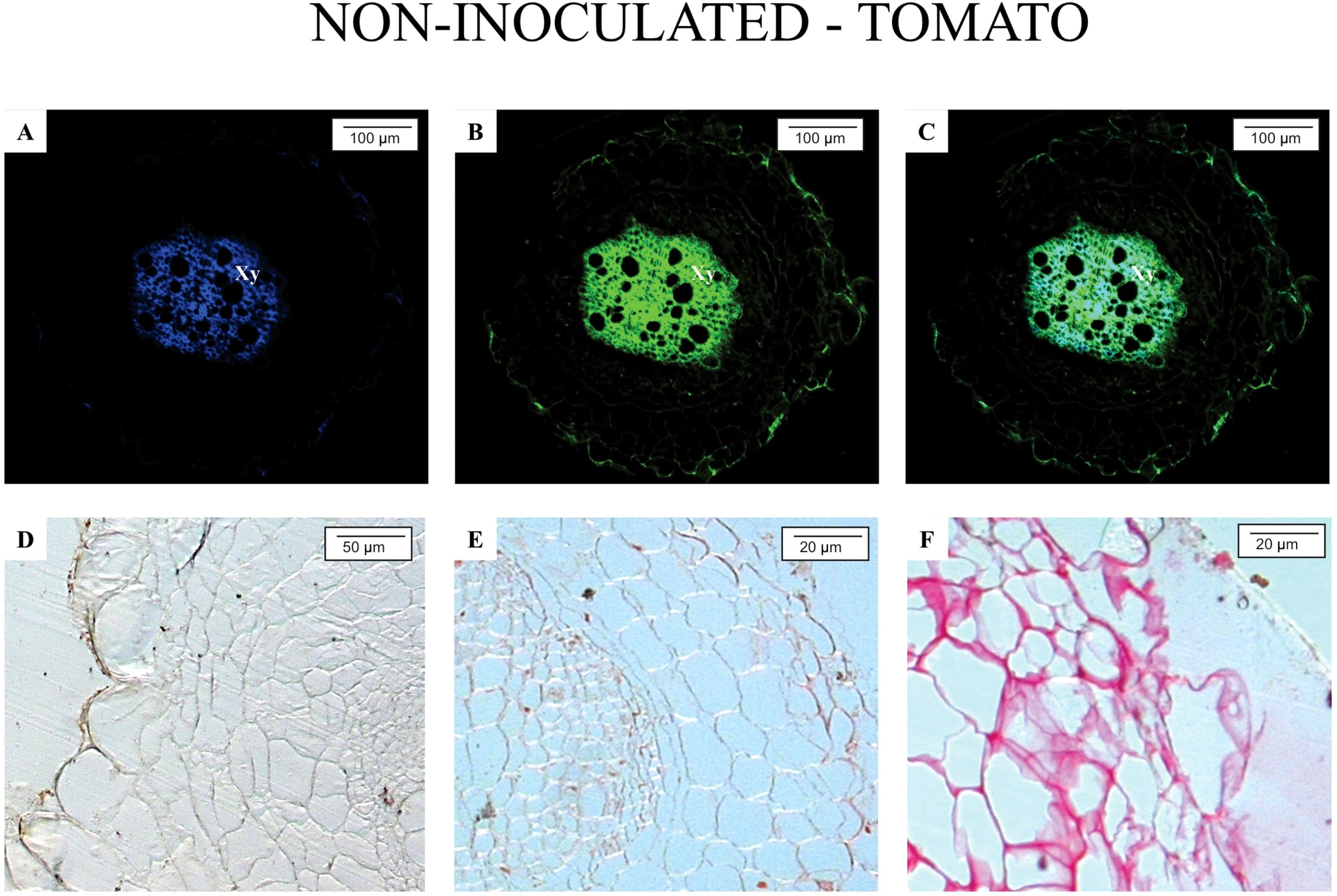 Non-inoculated tomato root sections, Panels A to F. Panel A shows a blue-stained section highlighting the xylem. Panels B and C display green fluorescence of surrounding tissues. Panels D to F exhibit tissue structure with light microscopy, with Panel F showing red-stained cells. Each panel includes a scale bar indicating magnification level.
